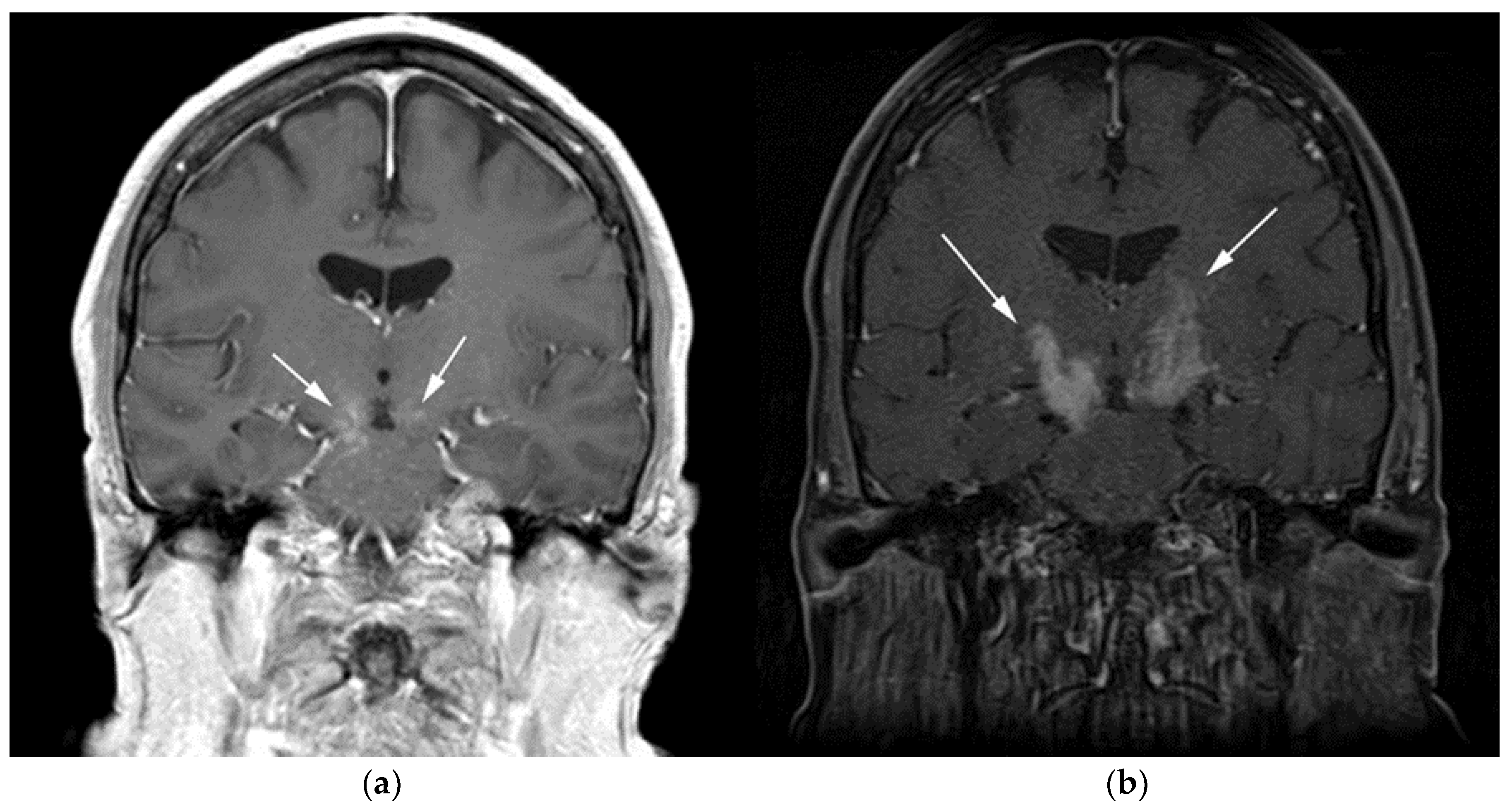 Cancers 13 05853 g002 Cancers 13 05853 g002