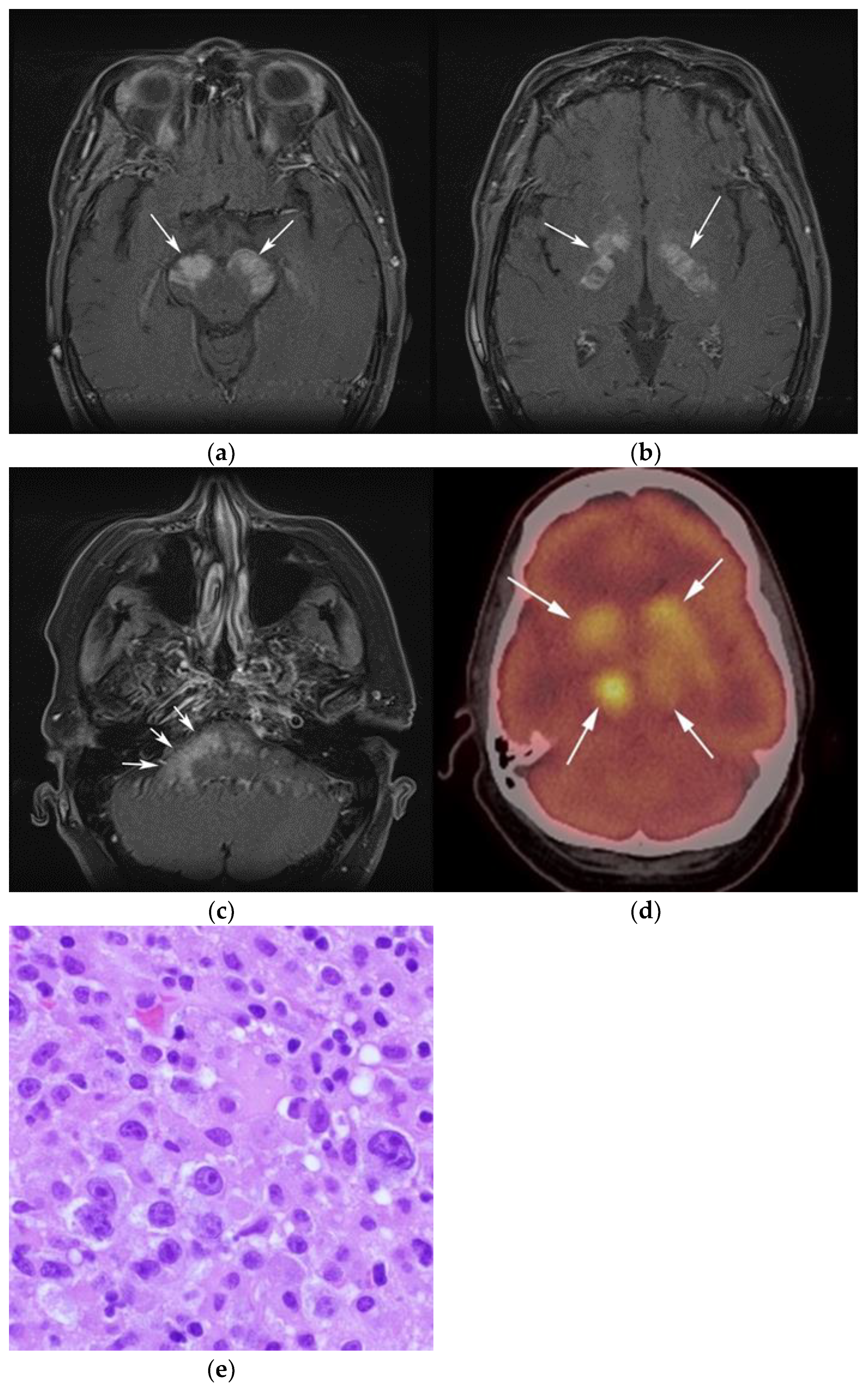 Cancers 13 05853 g003 Cancers 13 05853 g003