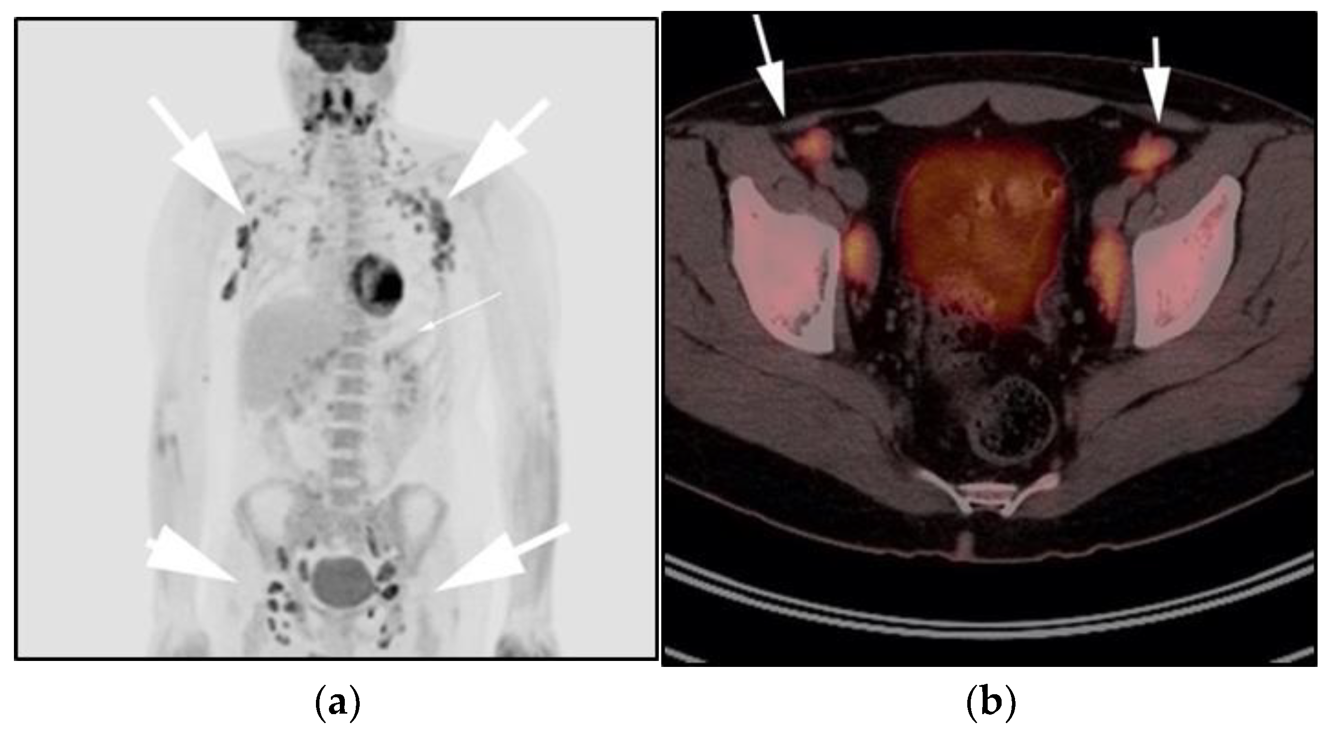 Cancers 13 05853 g004a Cancers 13 05853 g004a