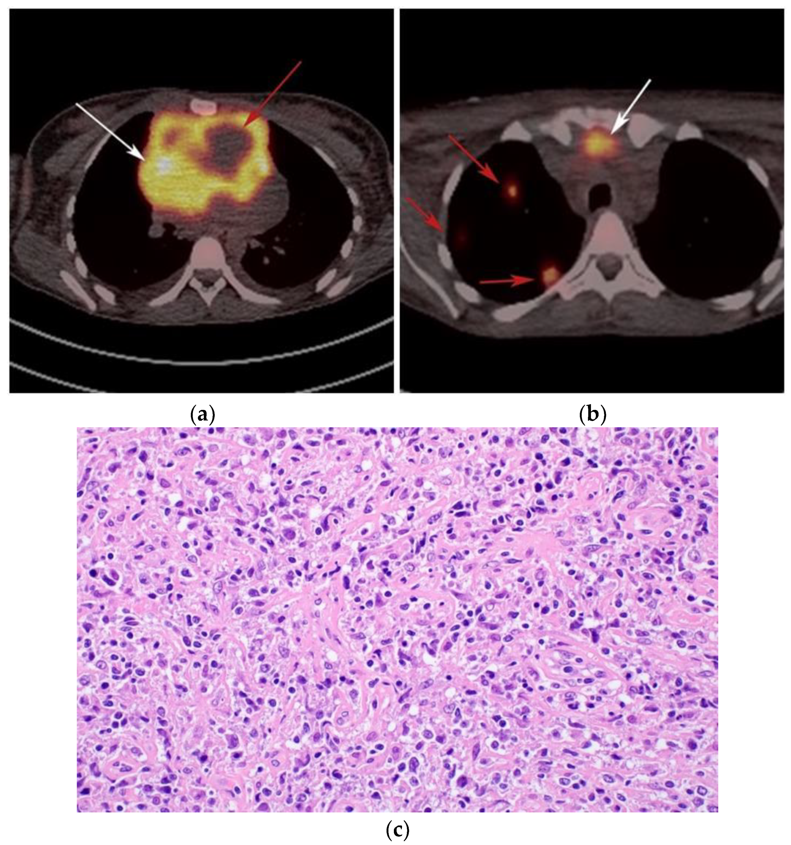 Cancers 13 05853 g006 Cancers 13 05853 g006