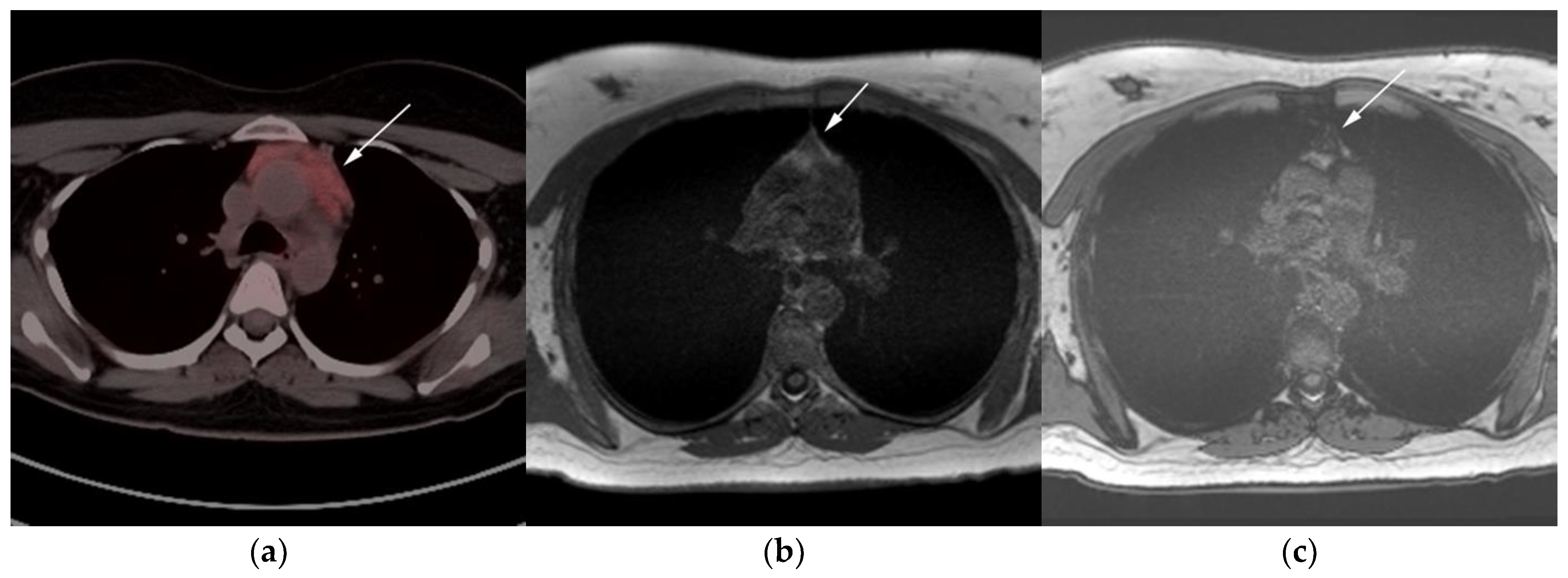 Cancers 13 05853 g007 Cancers 13 05853 g007