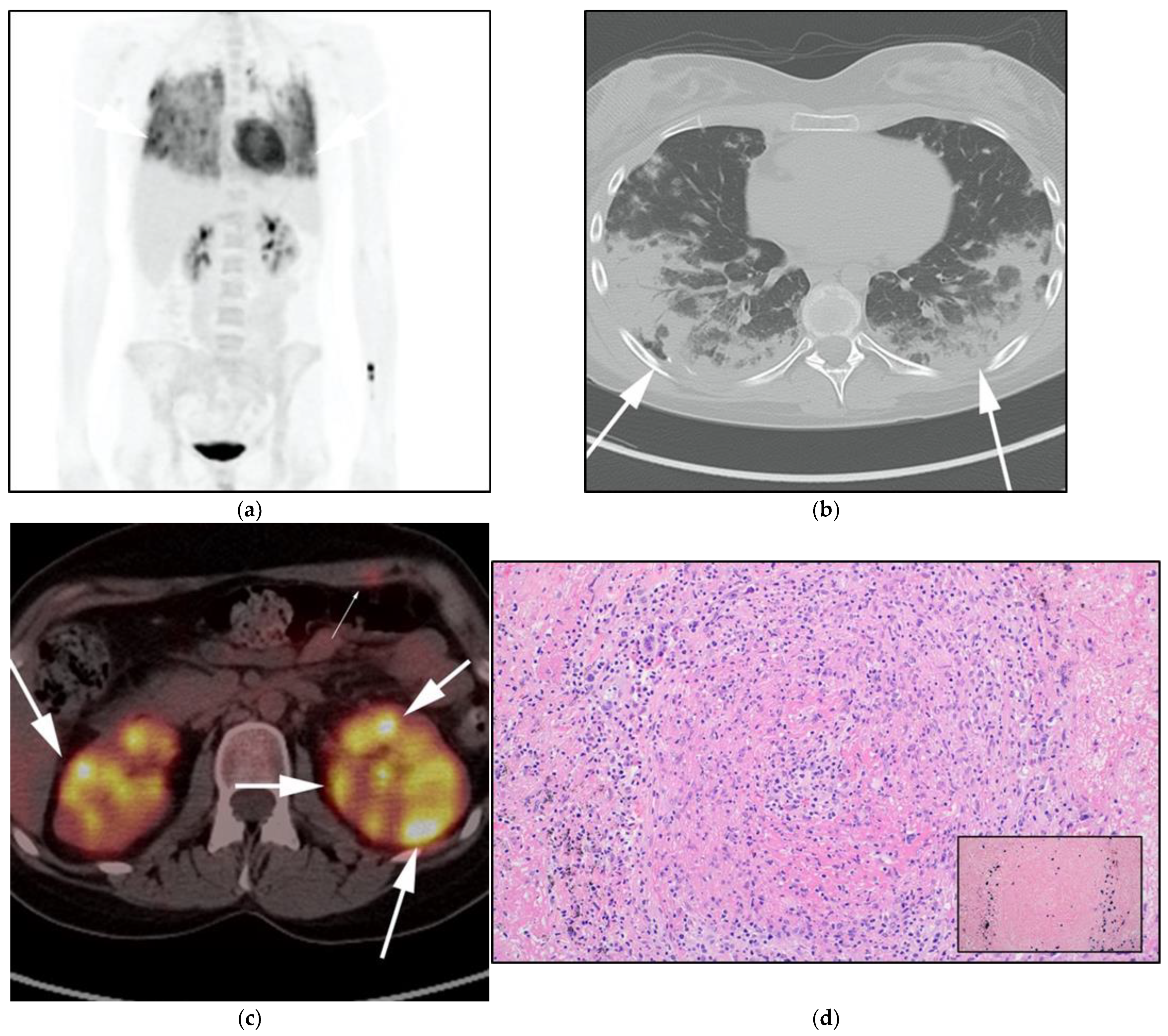 Cancers 13 05853 g009 Cancers 13 05853 g009