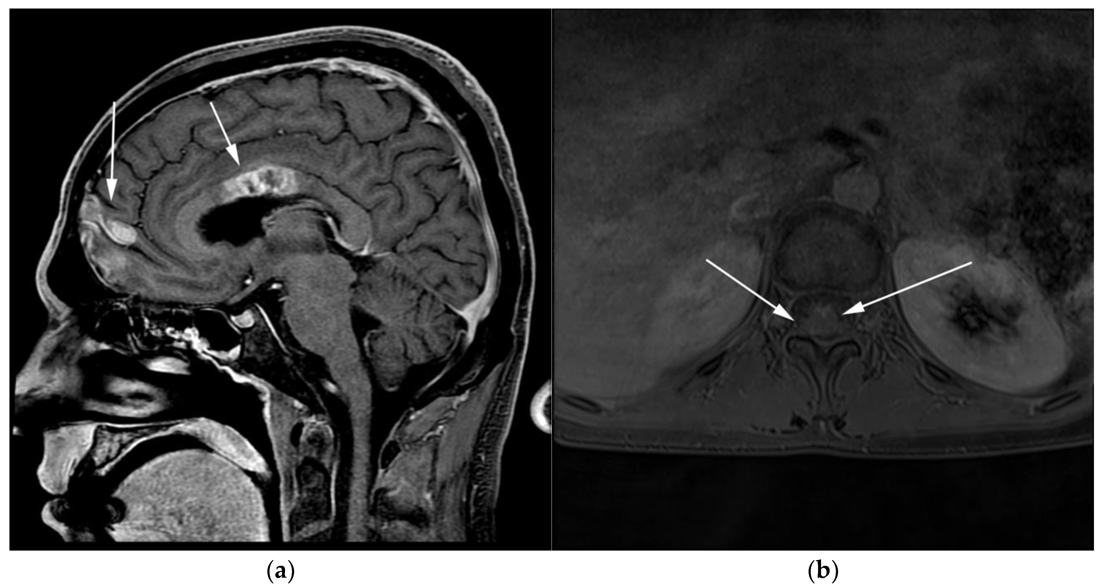 Cancers 13 05853 g010 Cancers 13 05853 g010