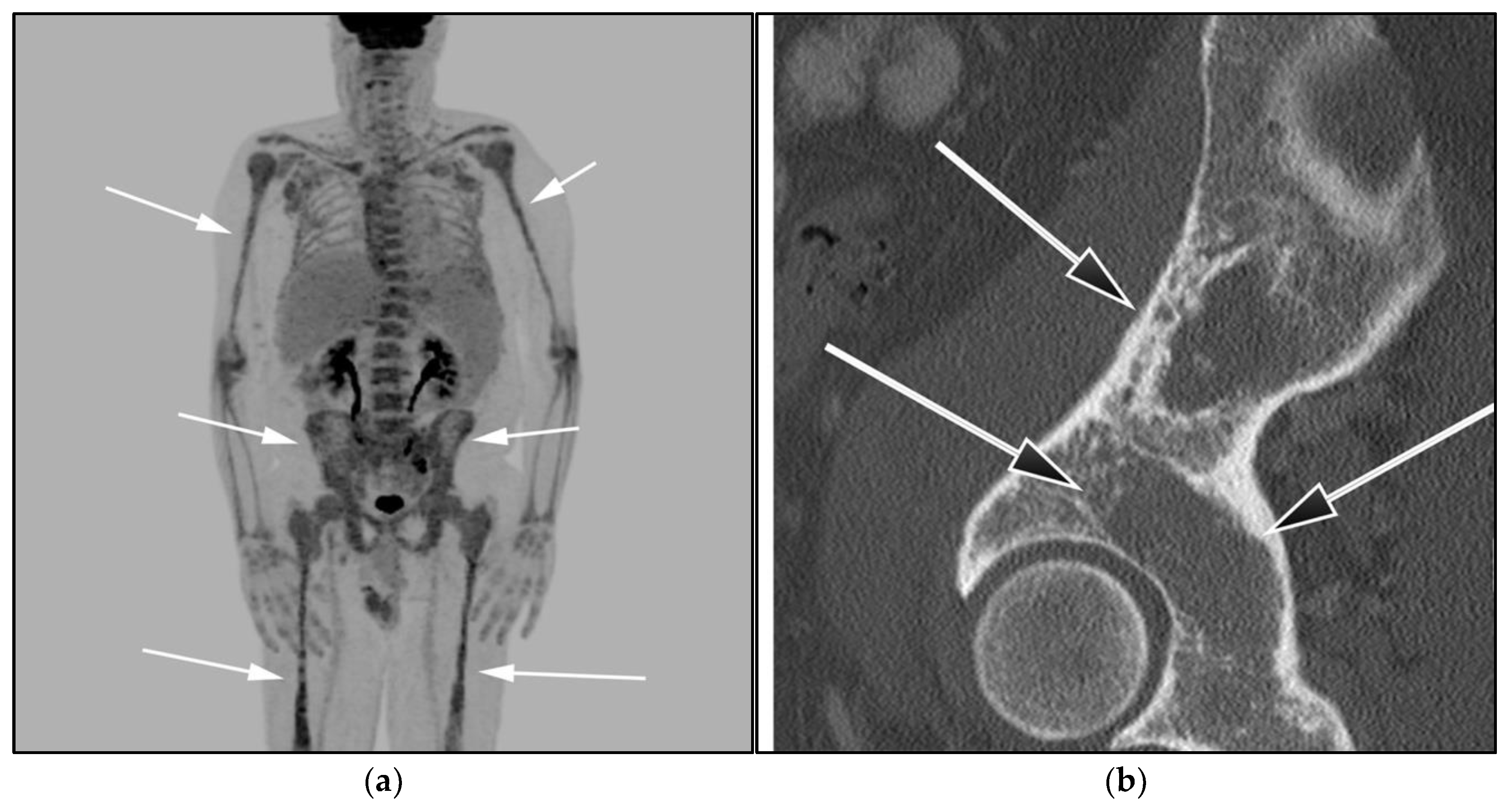 Cancers 13 05853 g011 Cancers 13 05853 g011