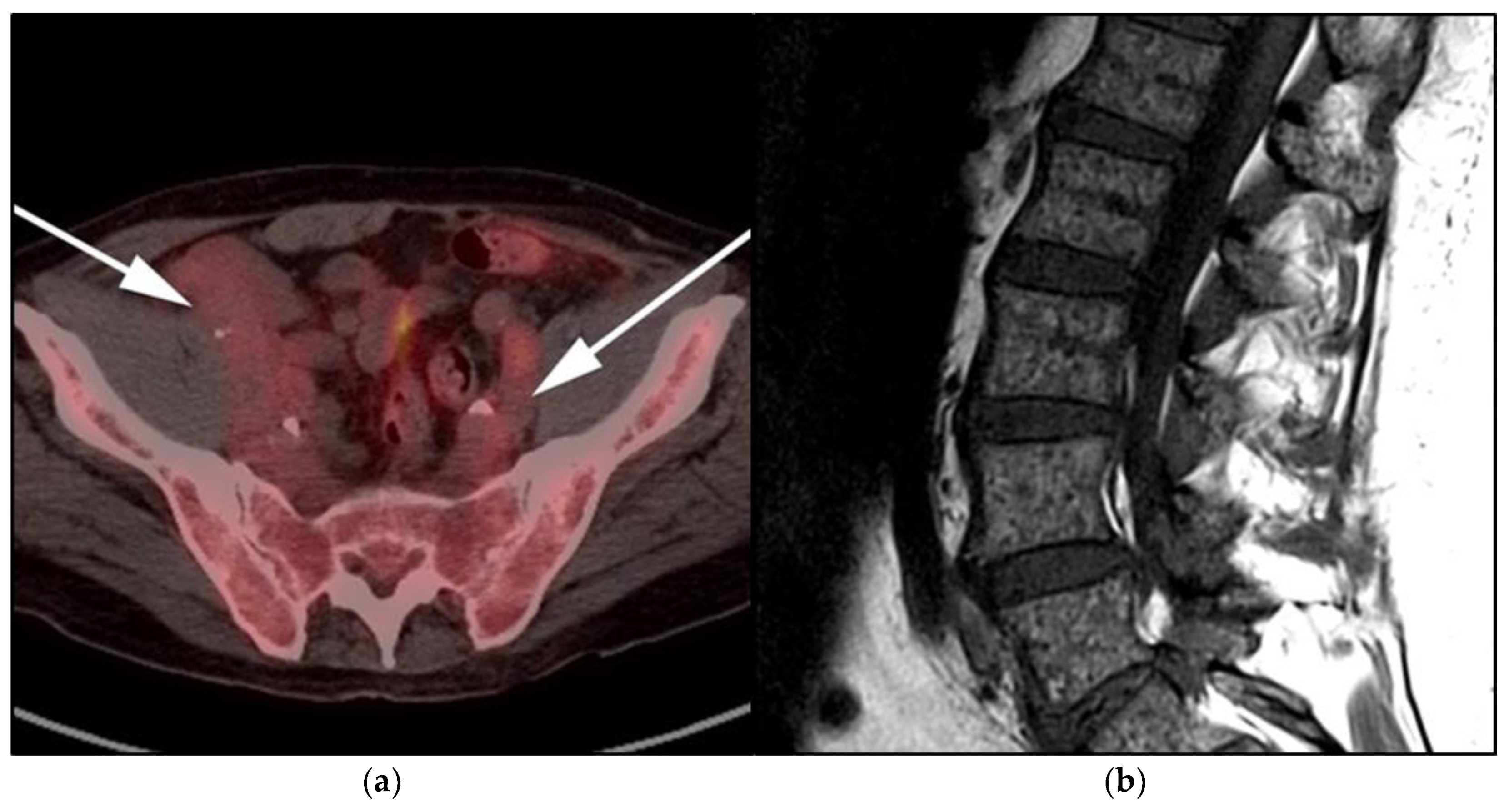 Cancers 13 05853 g012 Cancers 13 05853 g012