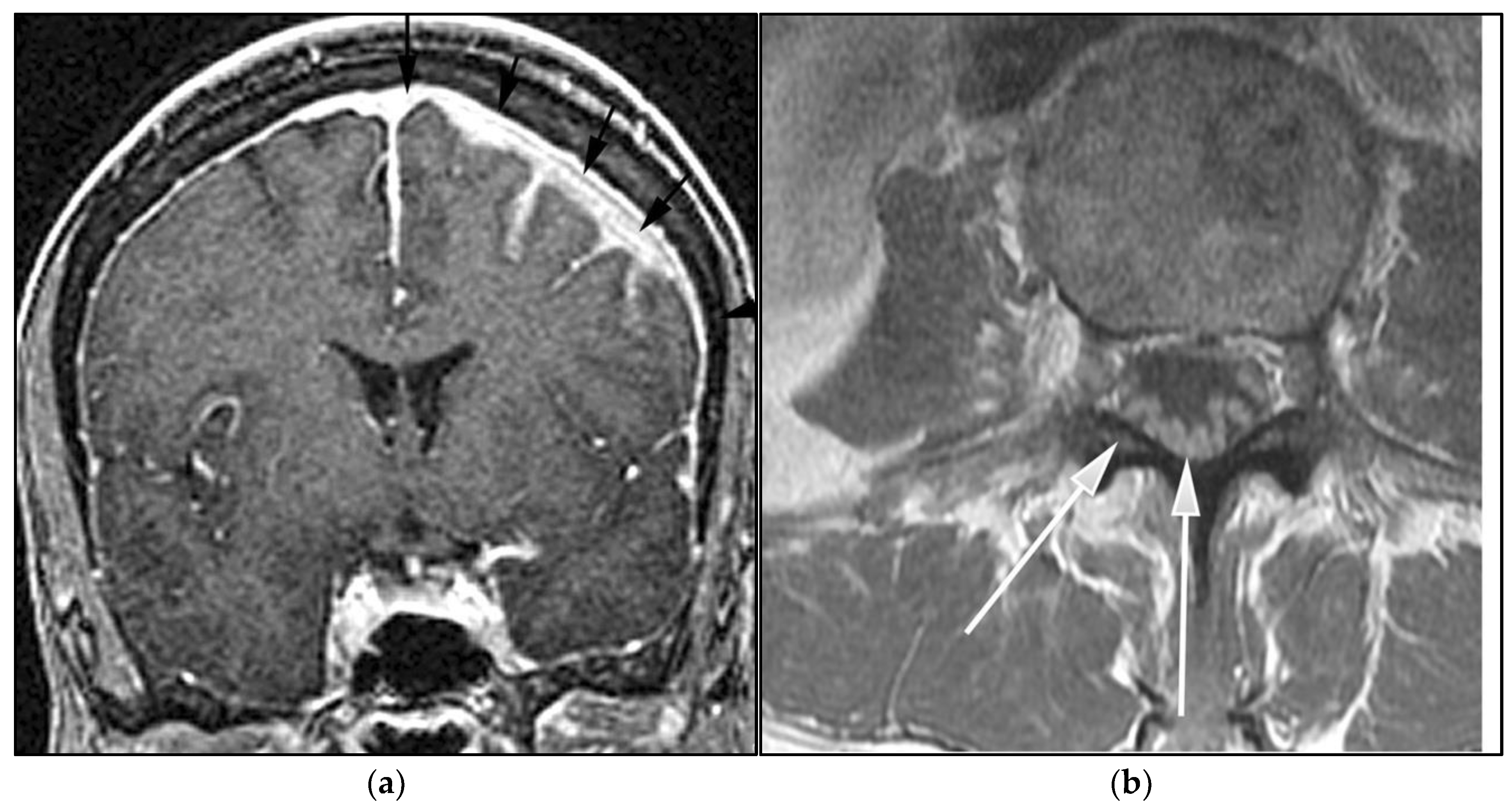 Cancers 13 05853 g013a Cancers 13 05853 g013a