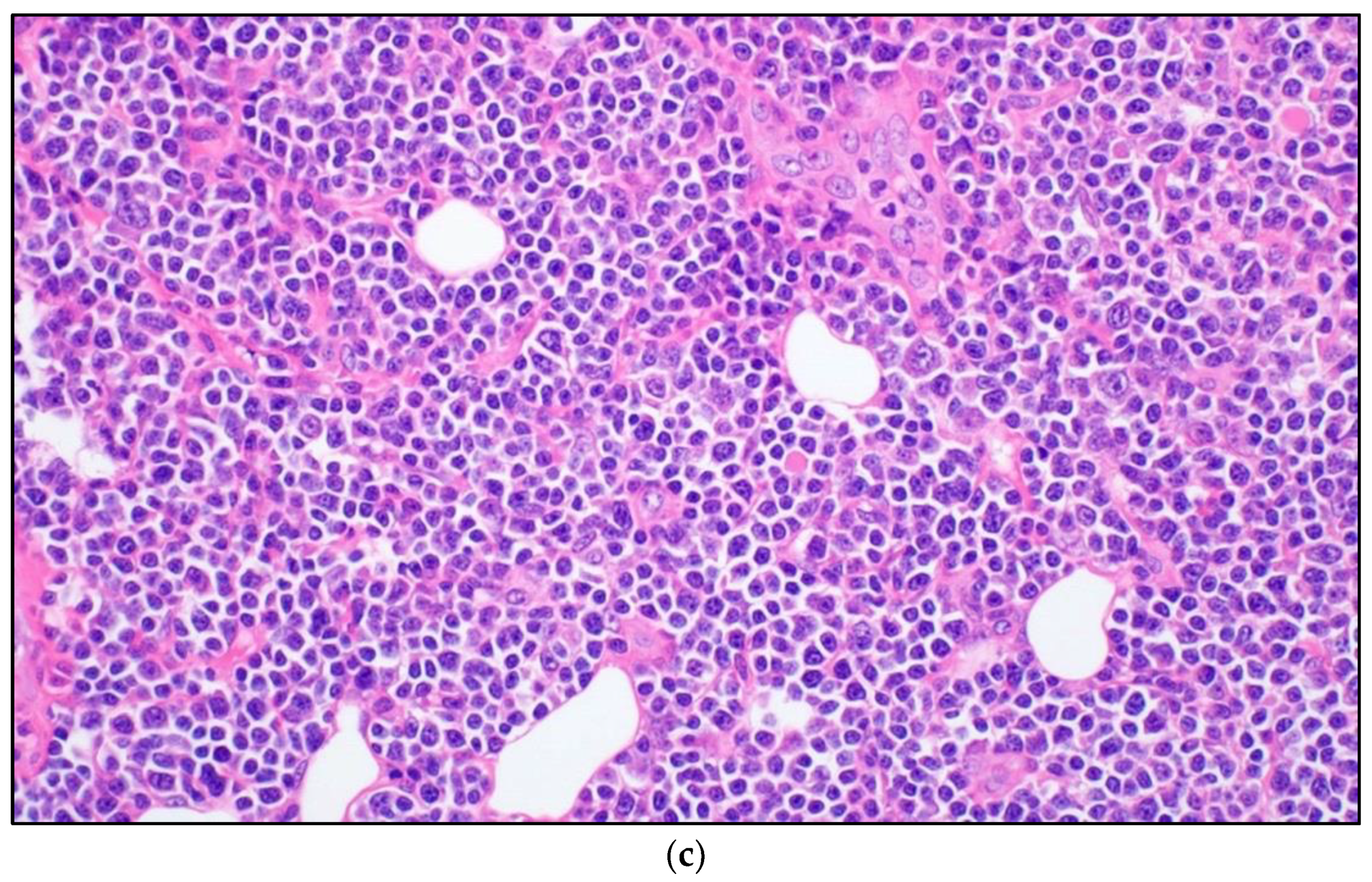 Cancers 13 05853 g013b Cancers 13 05853 g013b