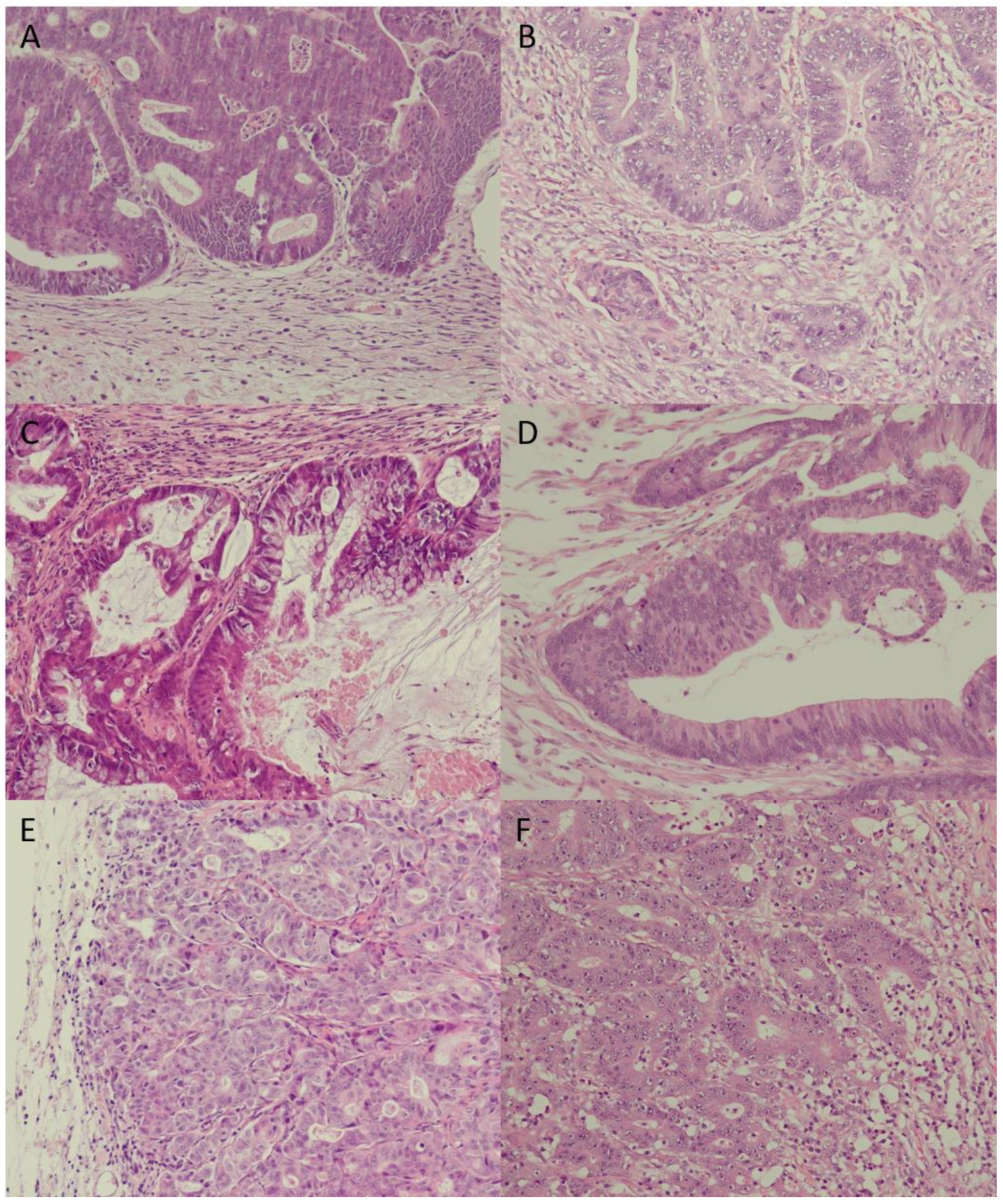 Cancers 13 05882 g001 550