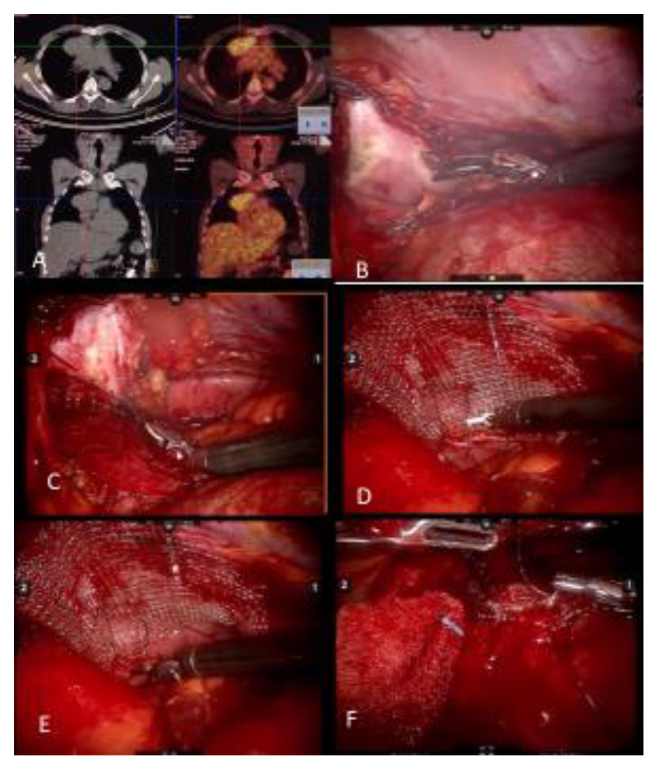 Cancers 13 05887 g001