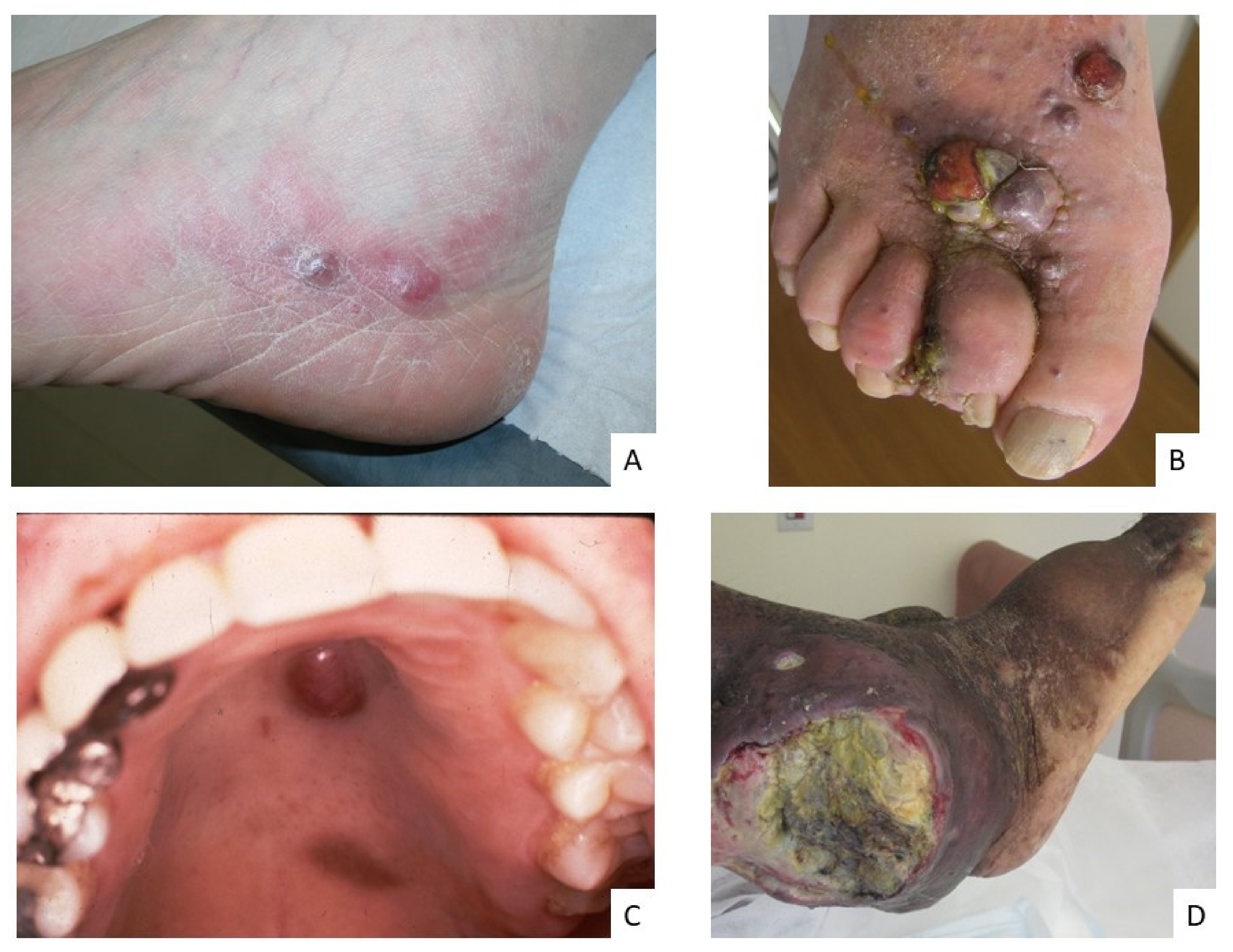 Cancers 13 05927 g001