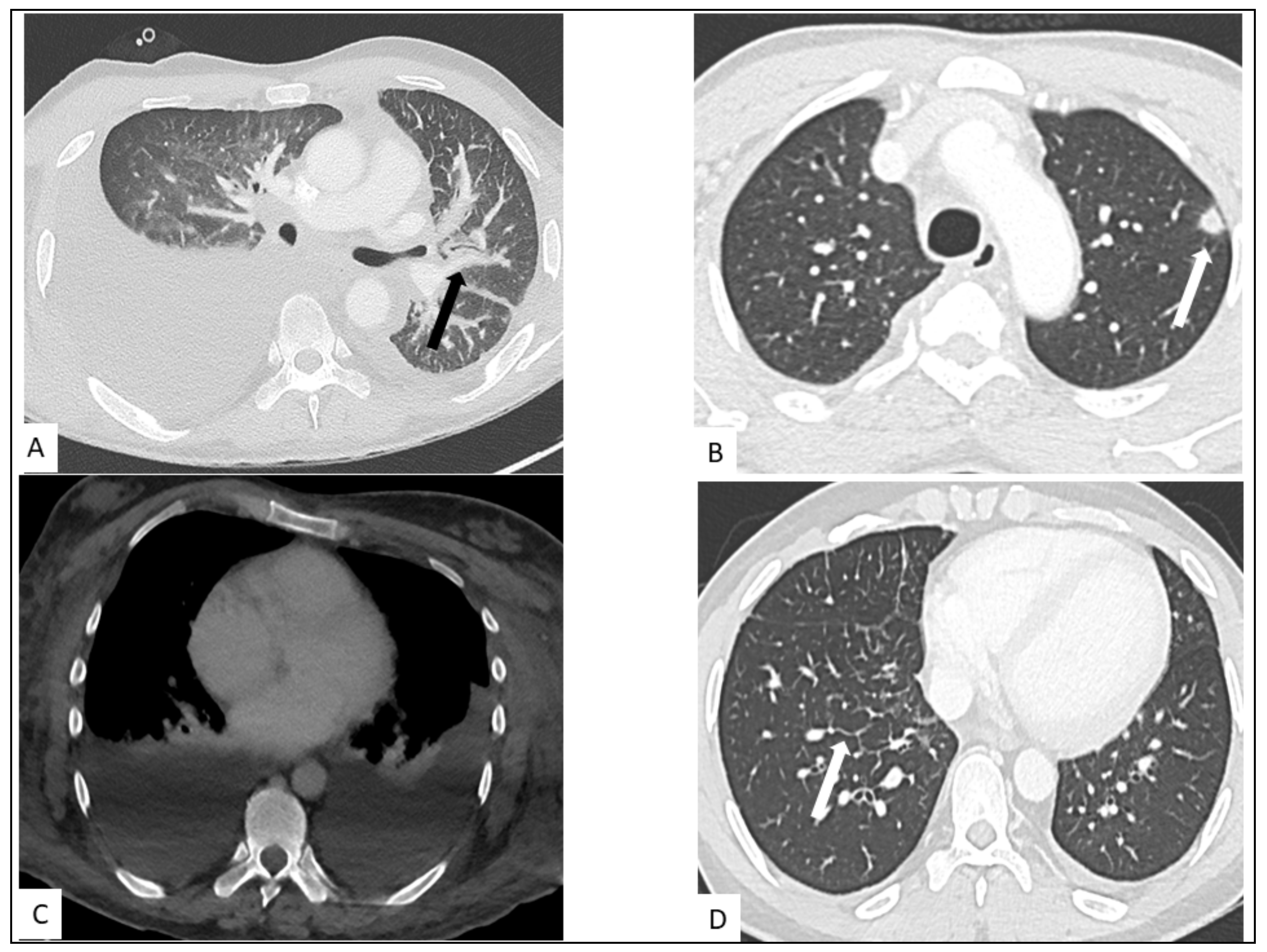 Cancers 13 05927 g004