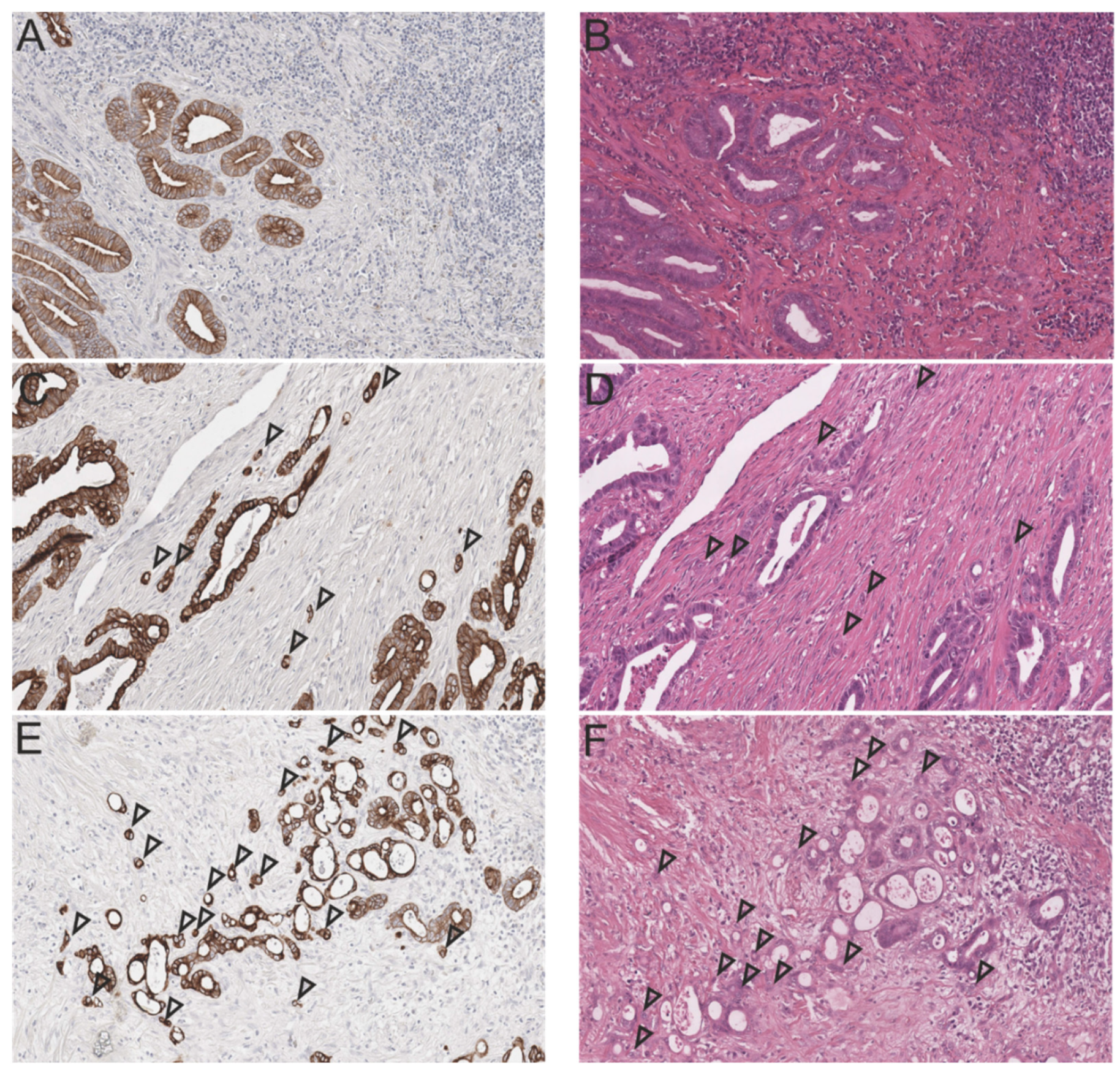 Cancers 13 05941 g001 550