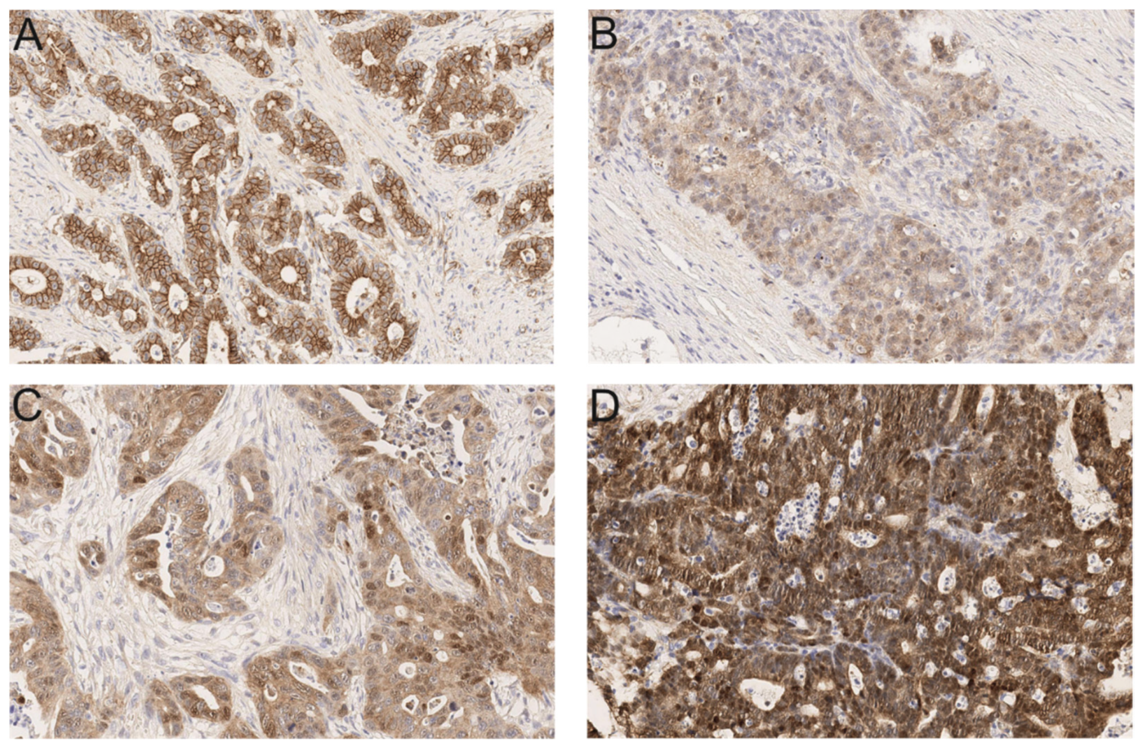 Cancers 13 05941 g002 550