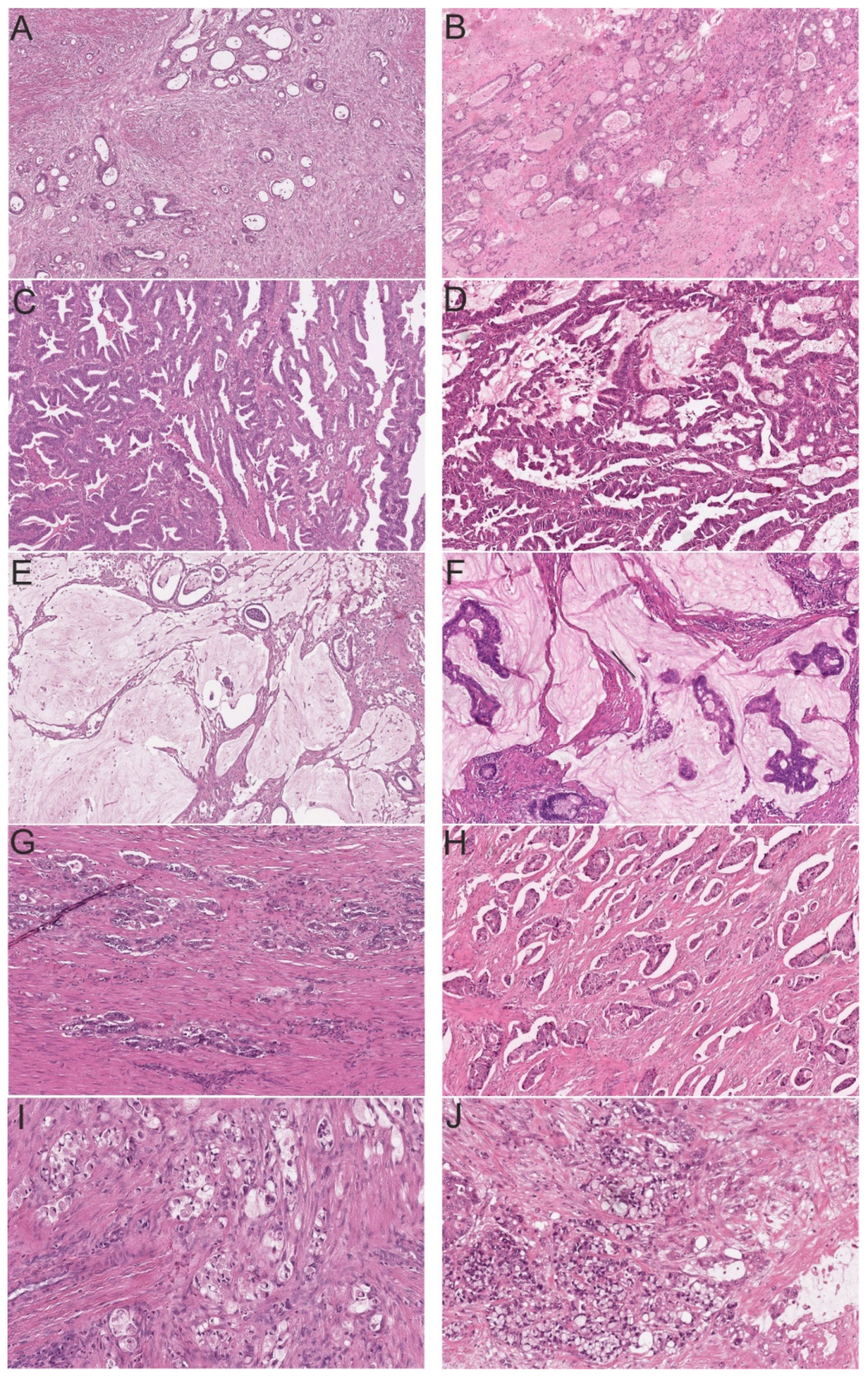 Cancers 13 05941 g003 550