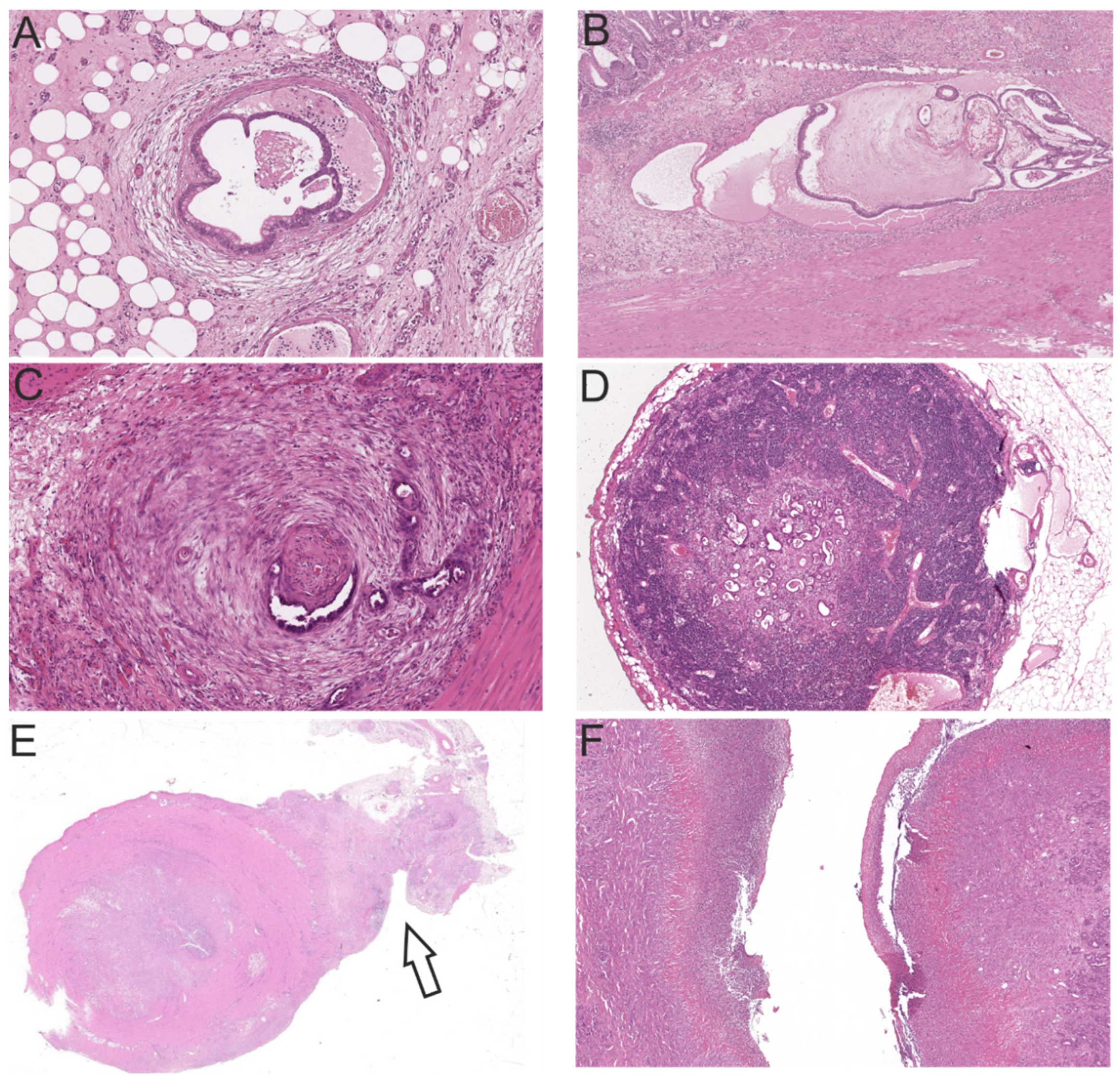 Cancers 13 05941 g004 550