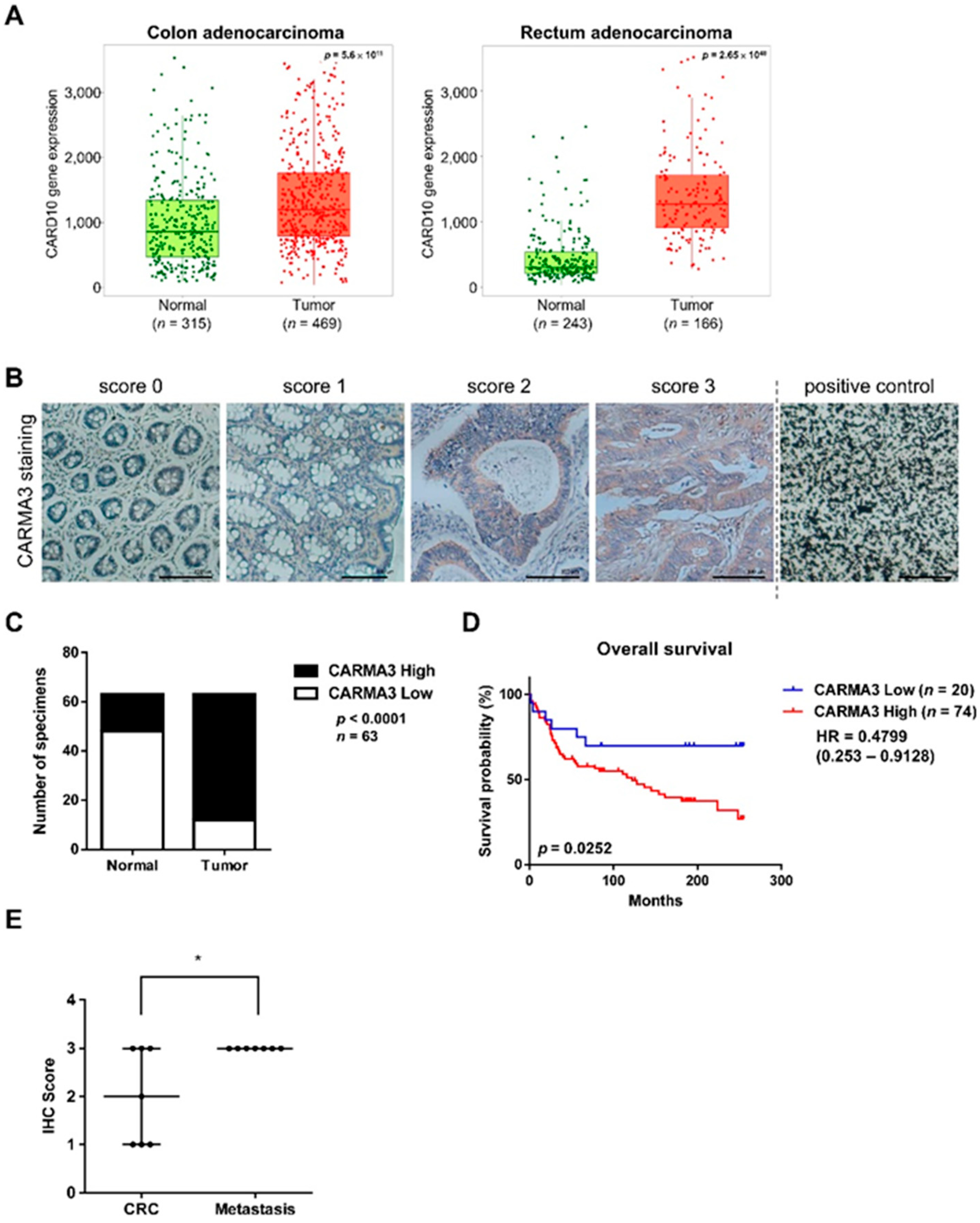 CARMA3 Promotes Colorectal Cancer Cell Motility and Cancer