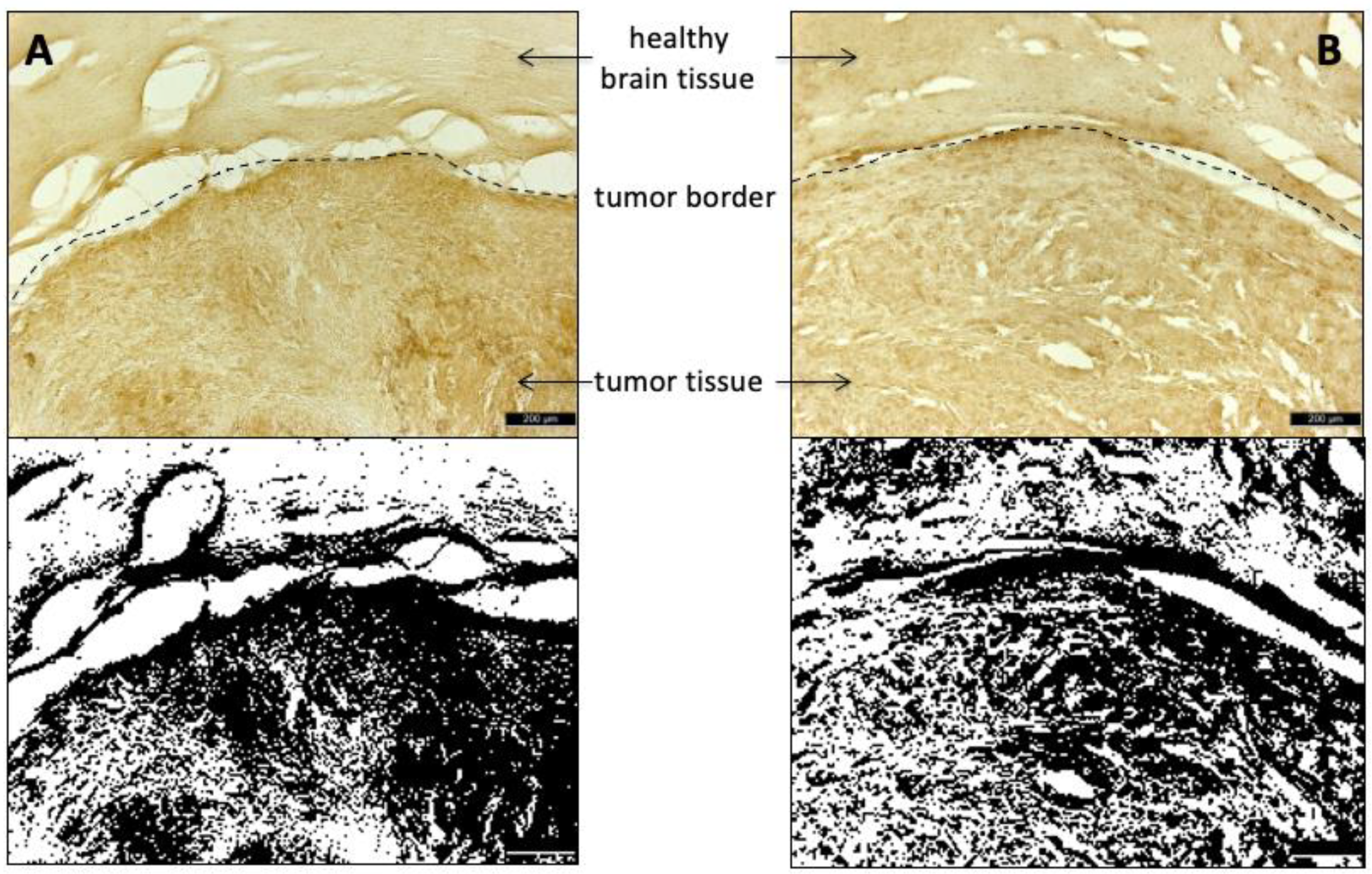 Cancers 13 06030 g010 550