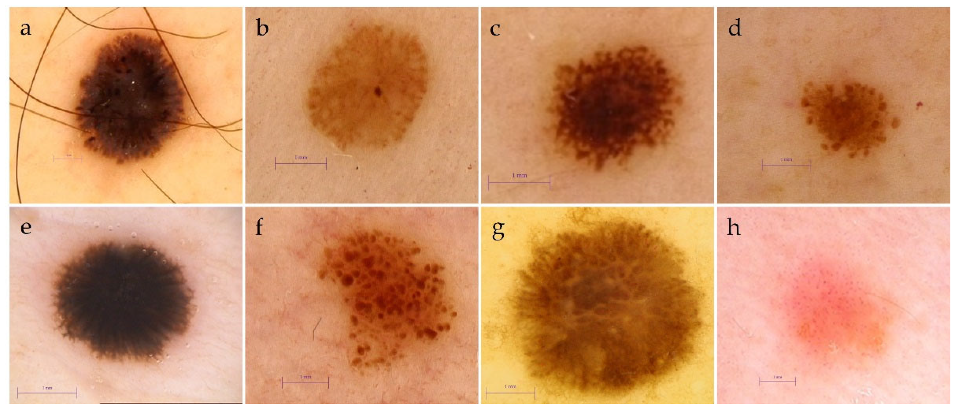 Cancers 13 06095 g001 Cancers 13 06095 g001