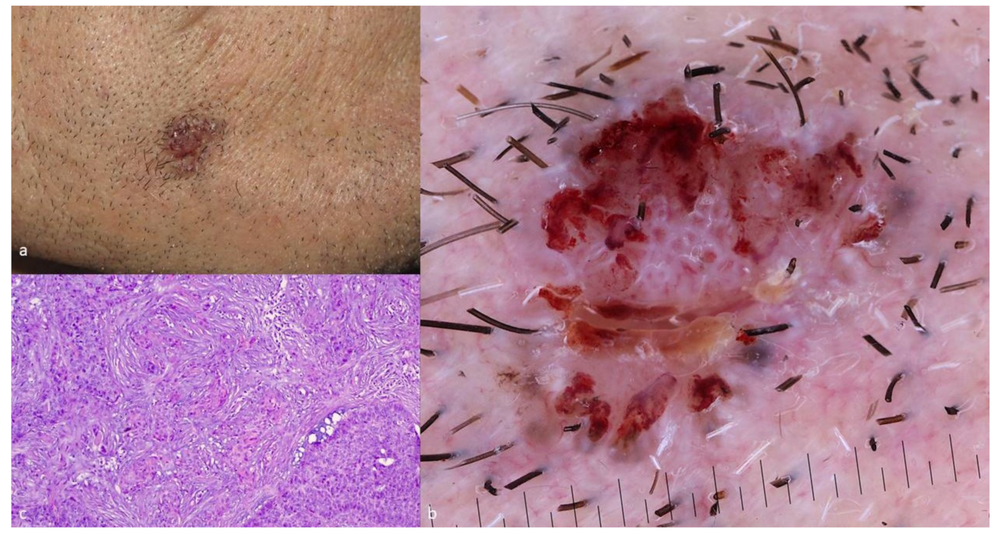 Cancers 13 06146 g001 Cancers 13 06146 g001