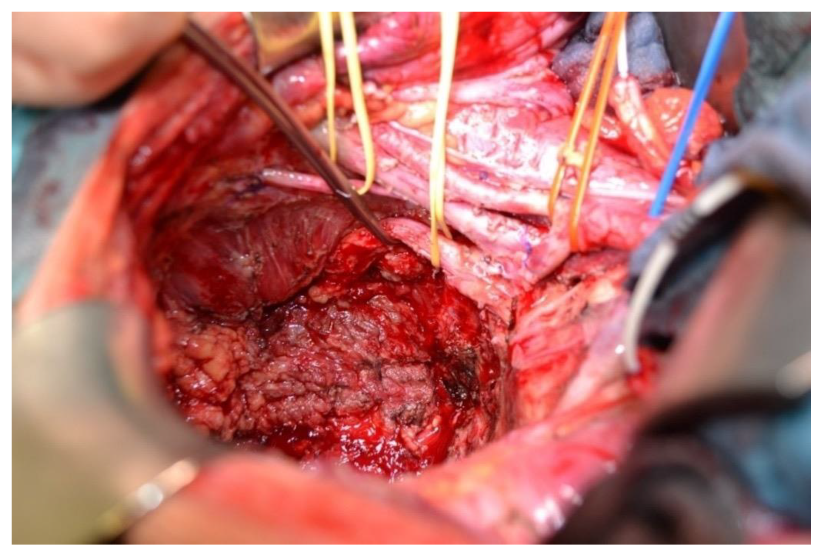 Cancers 13 06162 g001