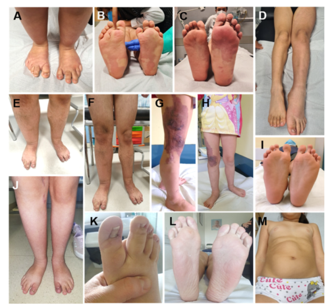 Cancers 13 06166 g004 550