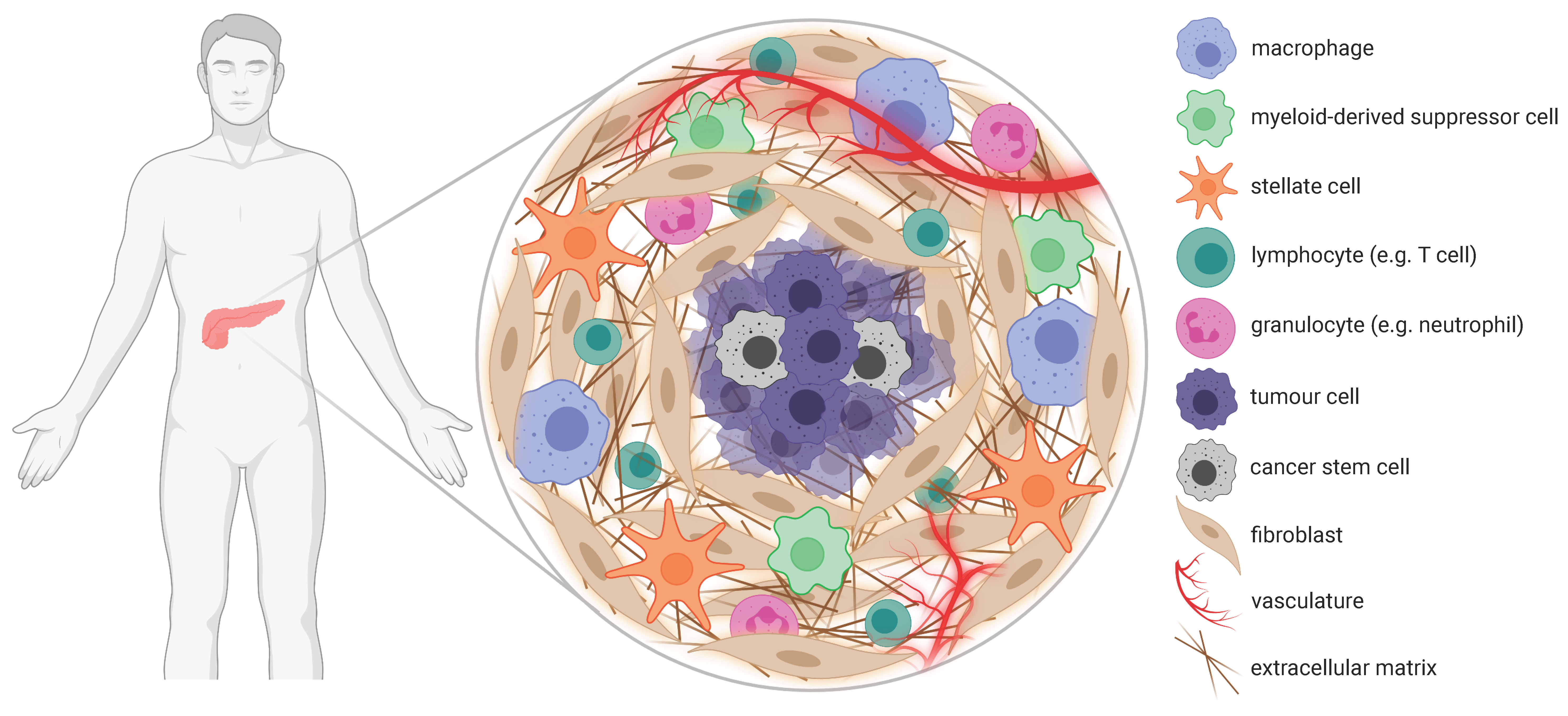Cancers | Free Full-Text | Nanomedicine in Pancreatic Cancer Cancers | Free Full-Text | Nanomedicine in Pancreatic Cancer