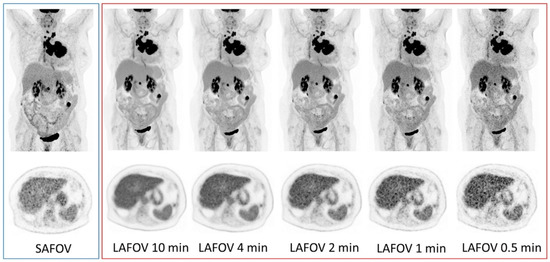 New Radionuclides and Technological Advances in SPECT and PET Scanners