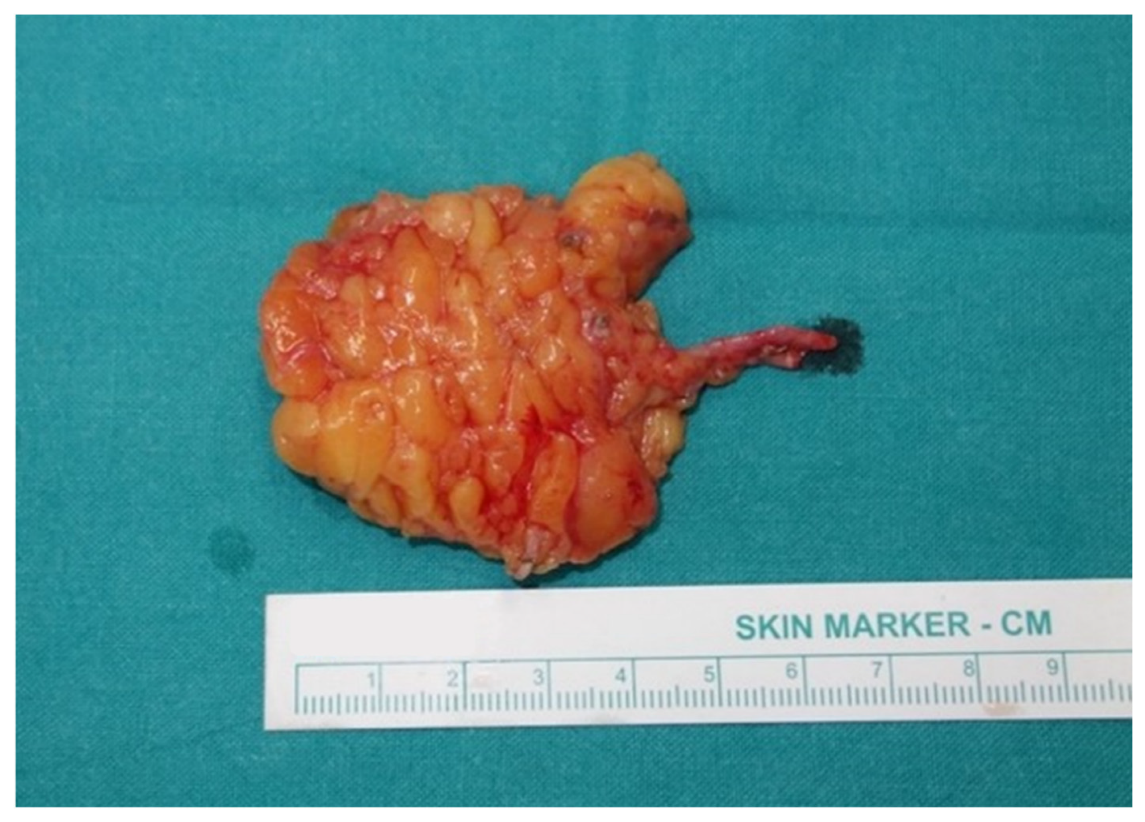 Cancers 13 06198 g001 550