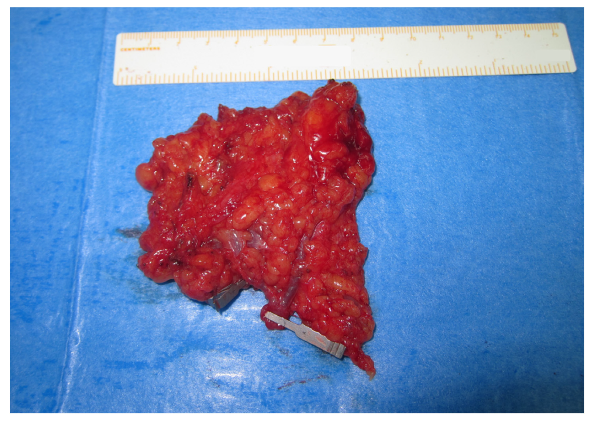 Cancers 13 06198 g002 550