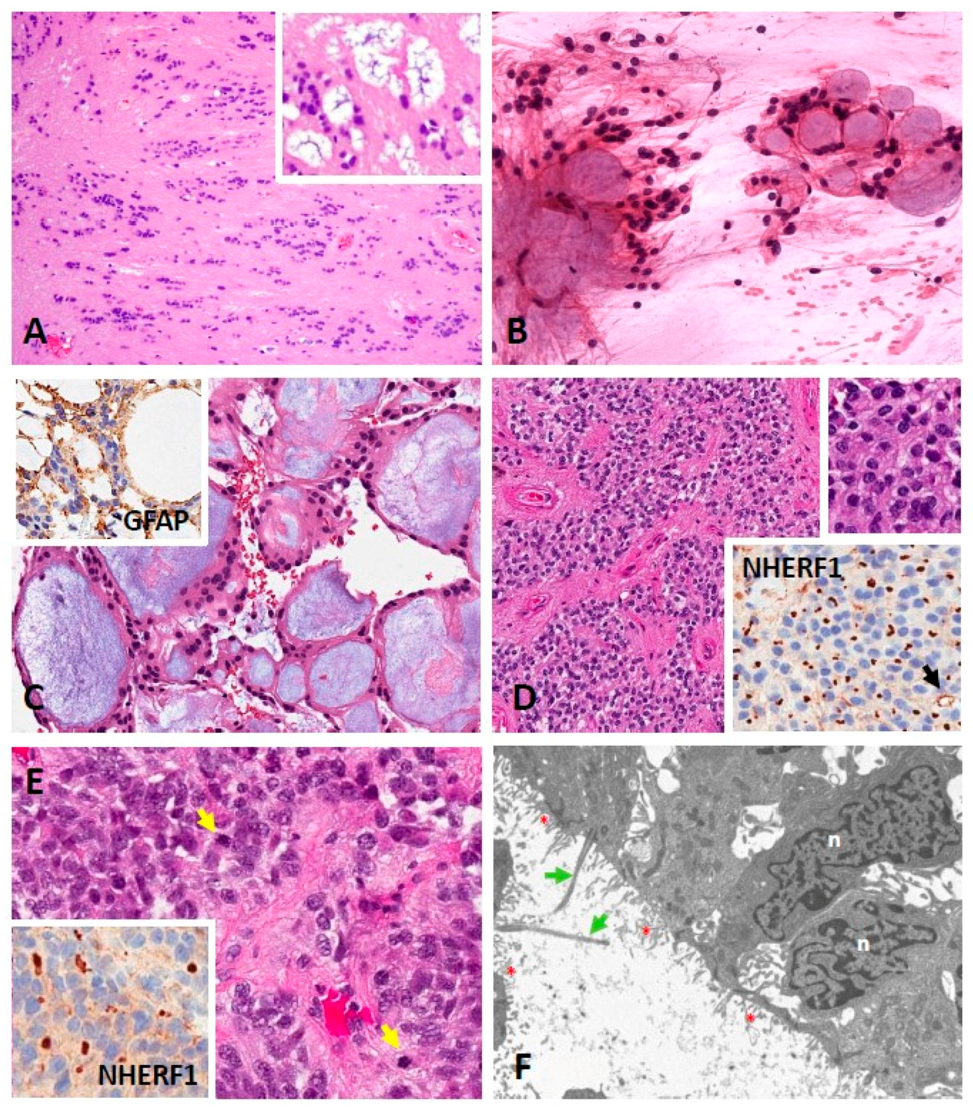 Cancers 13 06218 g002 Cancers 13 06218 g002