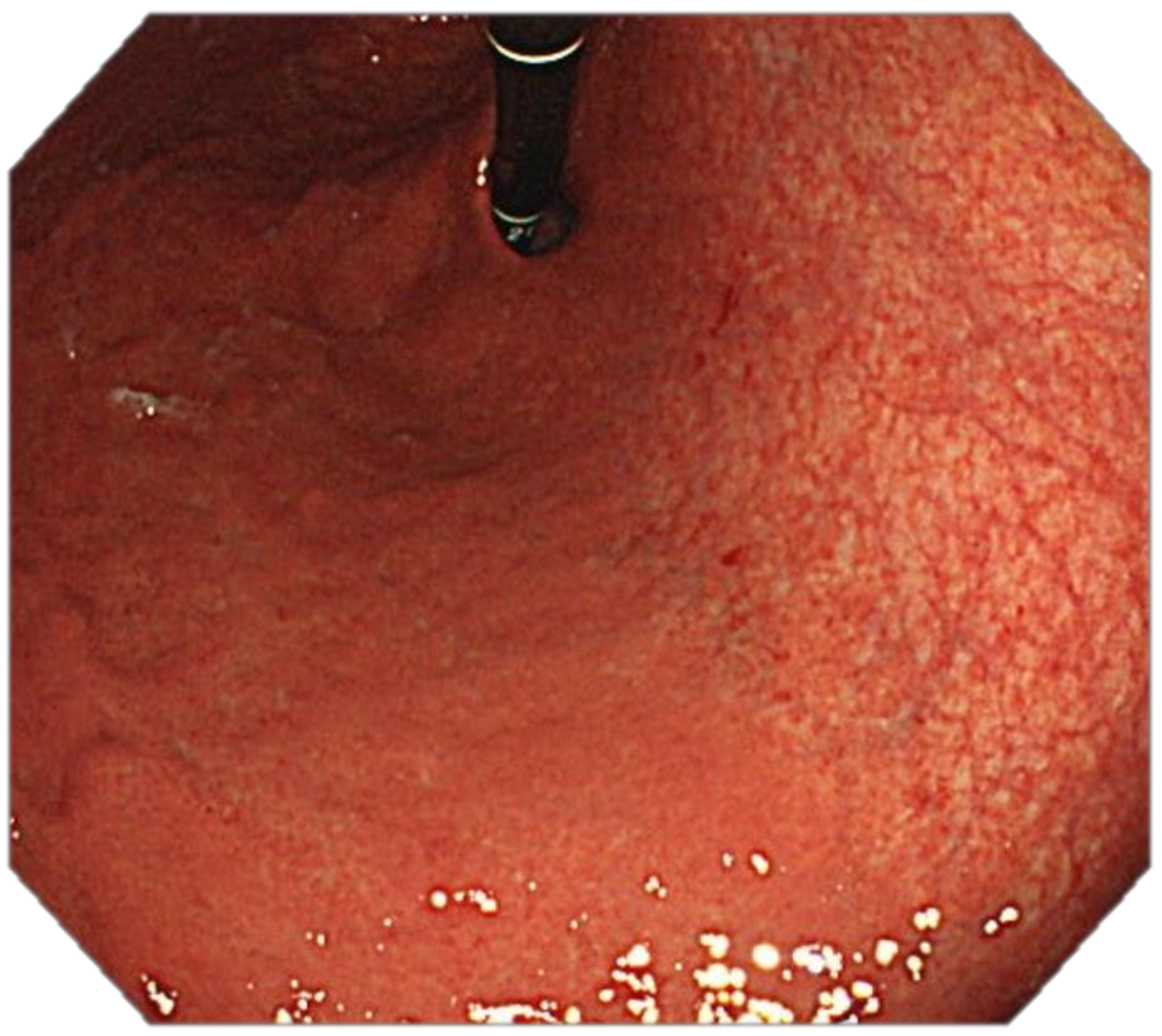 Cancers 13 06242 g004