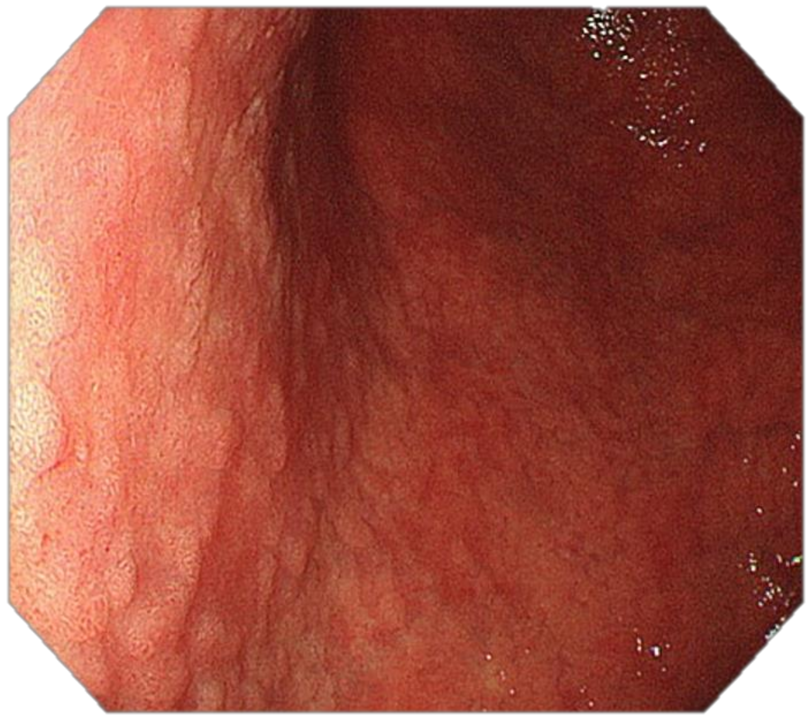 Cancers 13 06242 g005