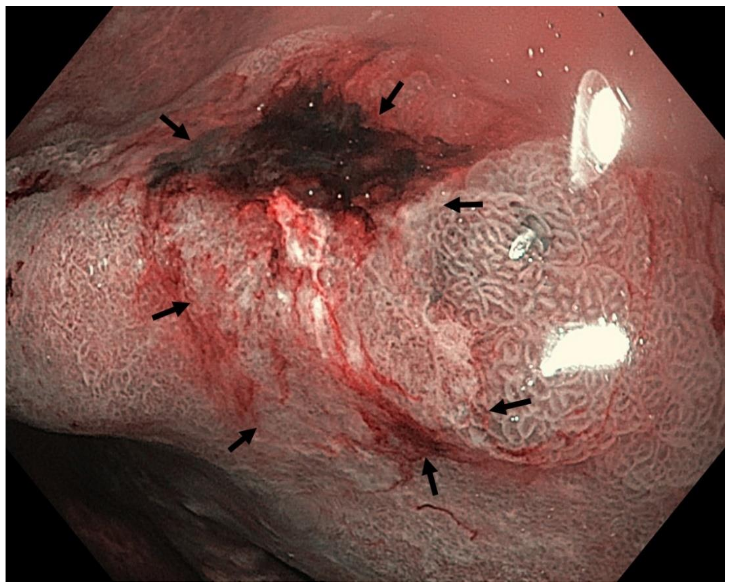 Cancers 13 06242 g009