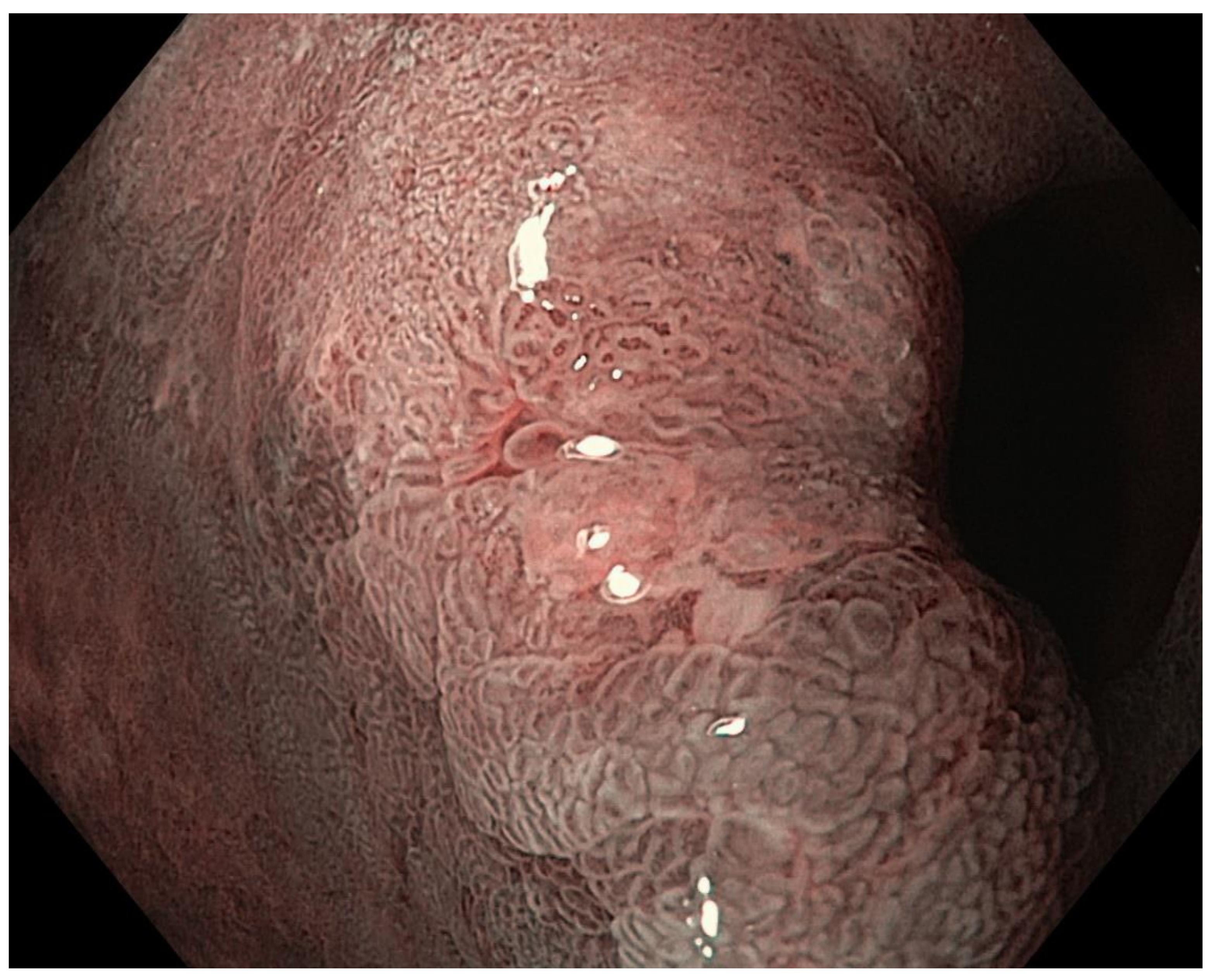 Cancers 13 06242 g010