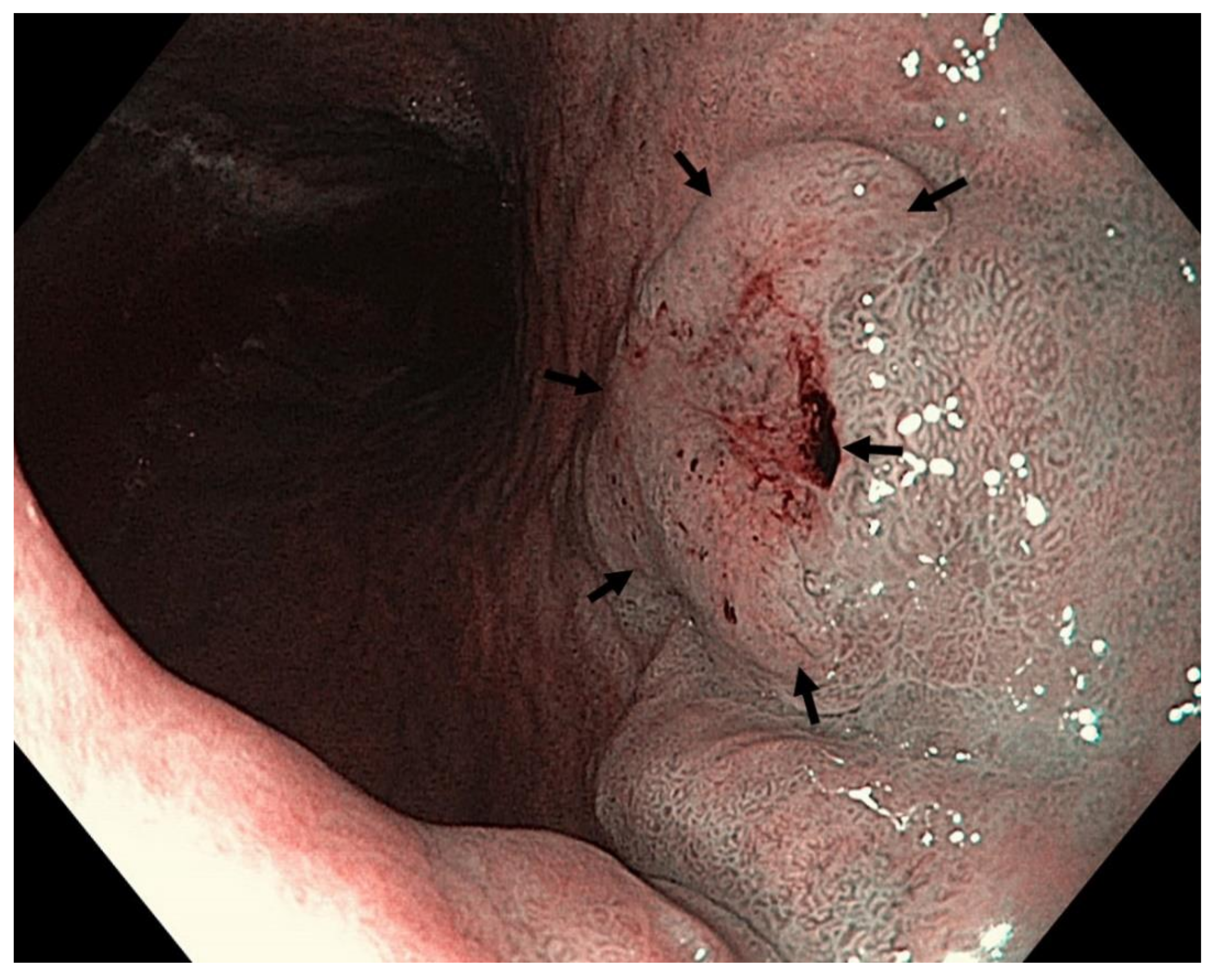 Cancers 13 06242 g013