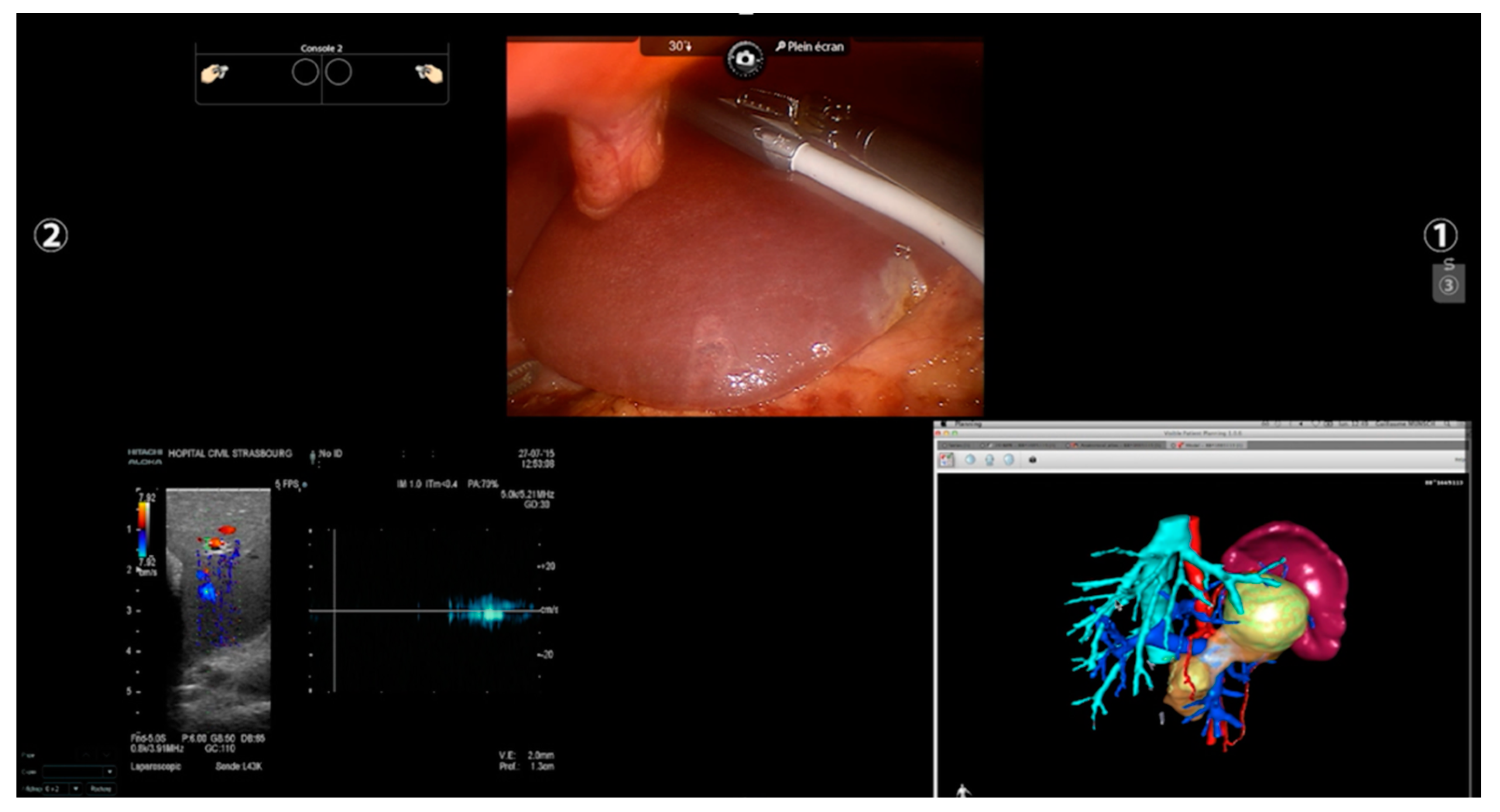 Cancers 13 06268 g004