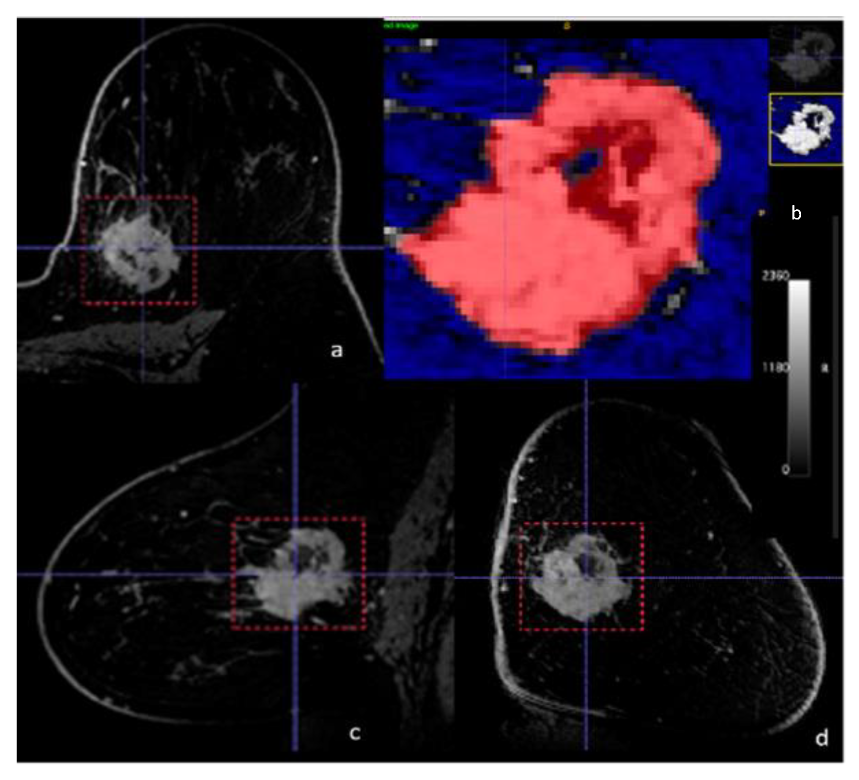 Cancers 13 06273 g002