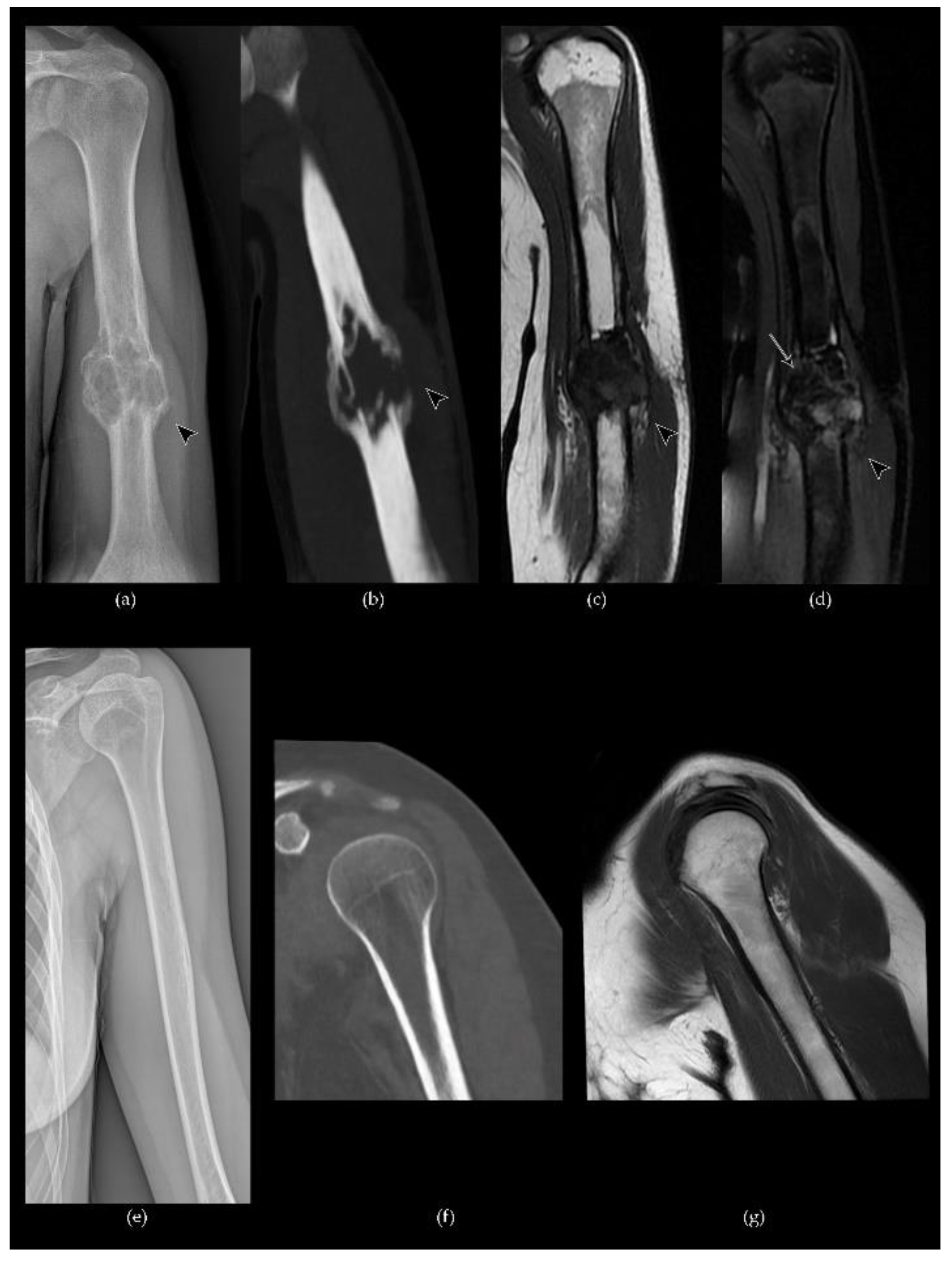 Cancers 13 06298 g004 Cancers 13 06298 g004