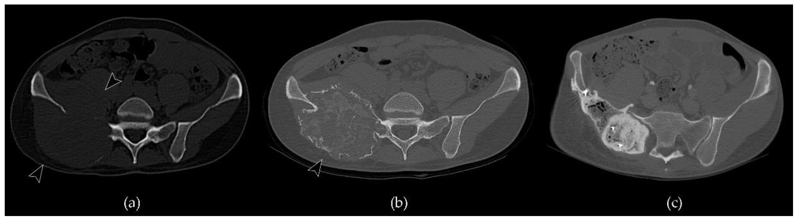 Cancers 13 06298 g007 Cancers 13 06298 g007