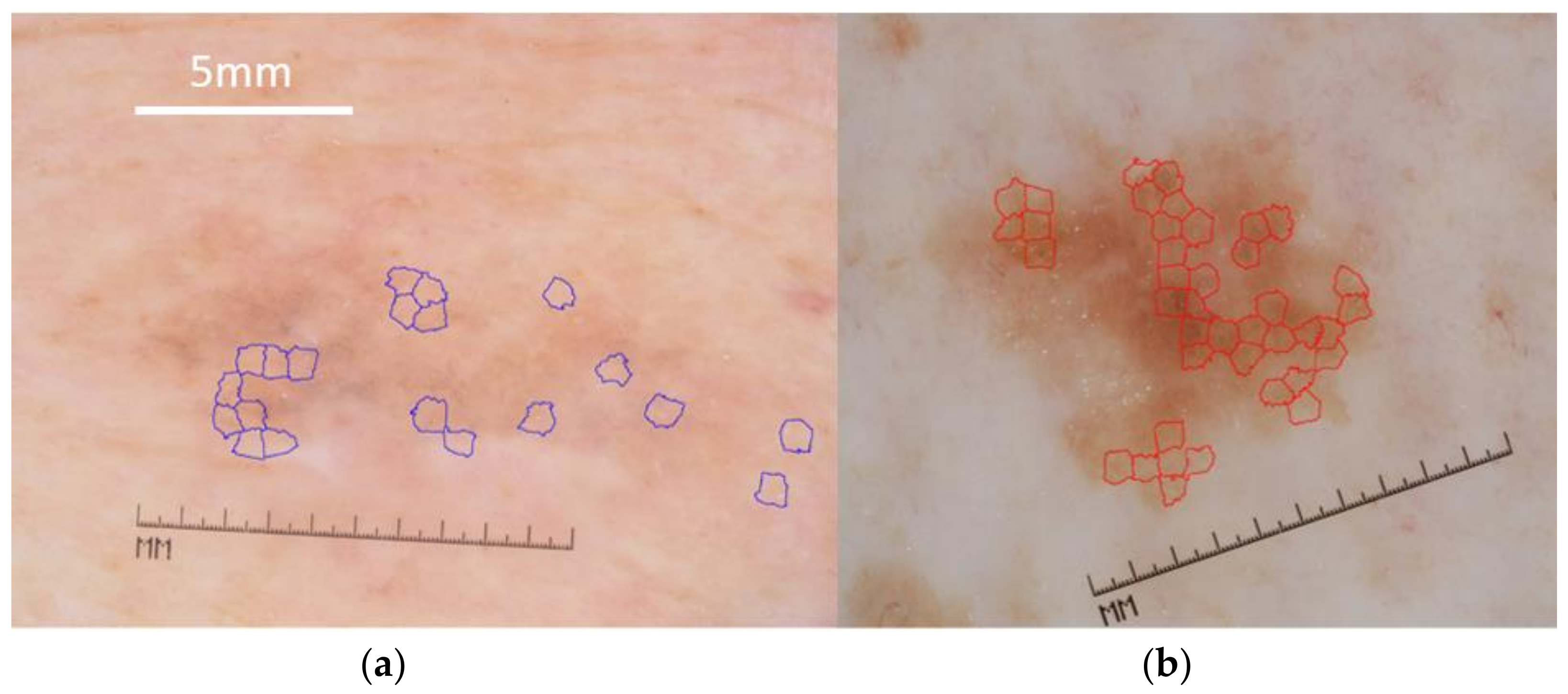 Cancers 13 06300 g001 550