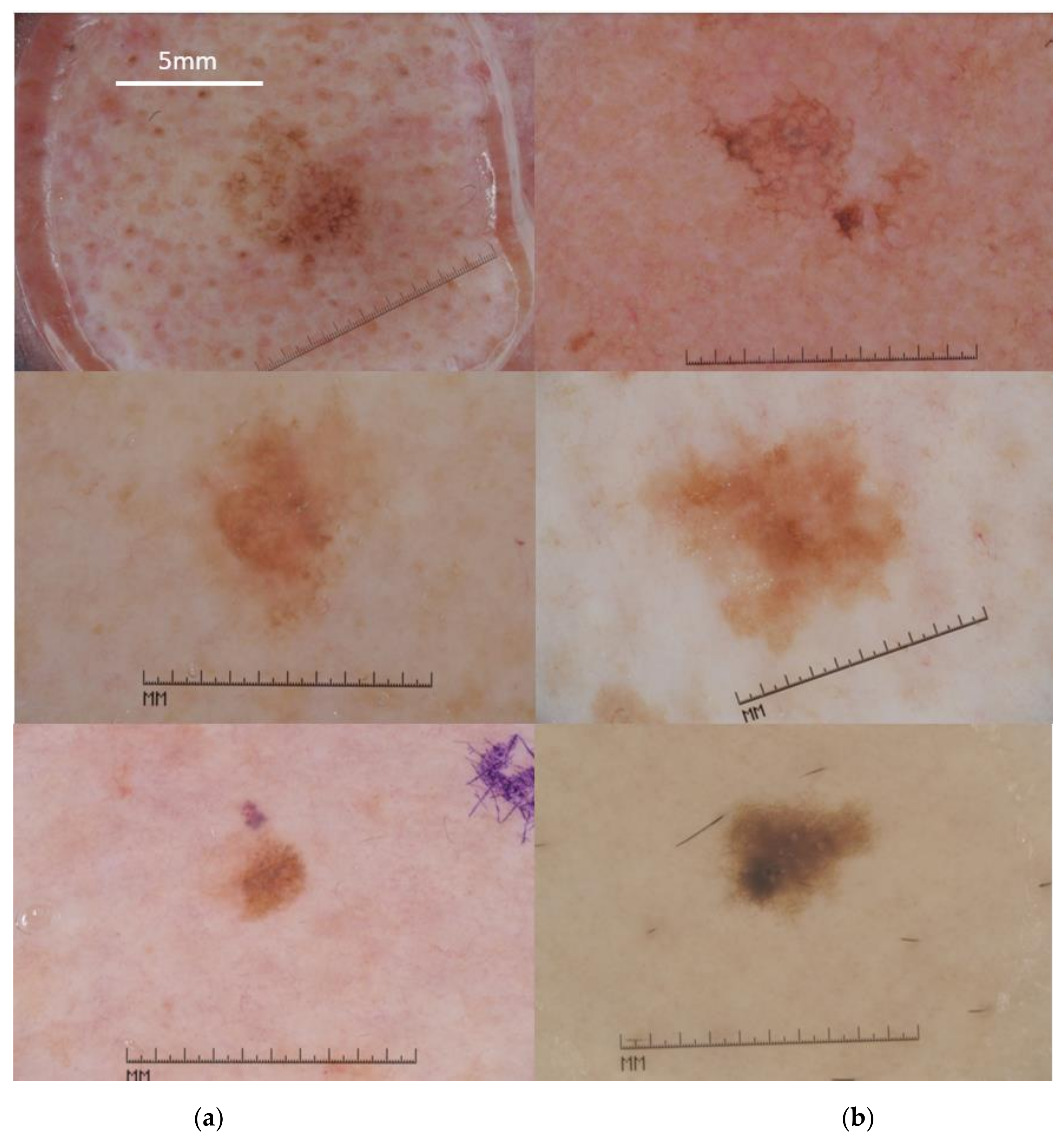 Cancers 13 06300 g002 550