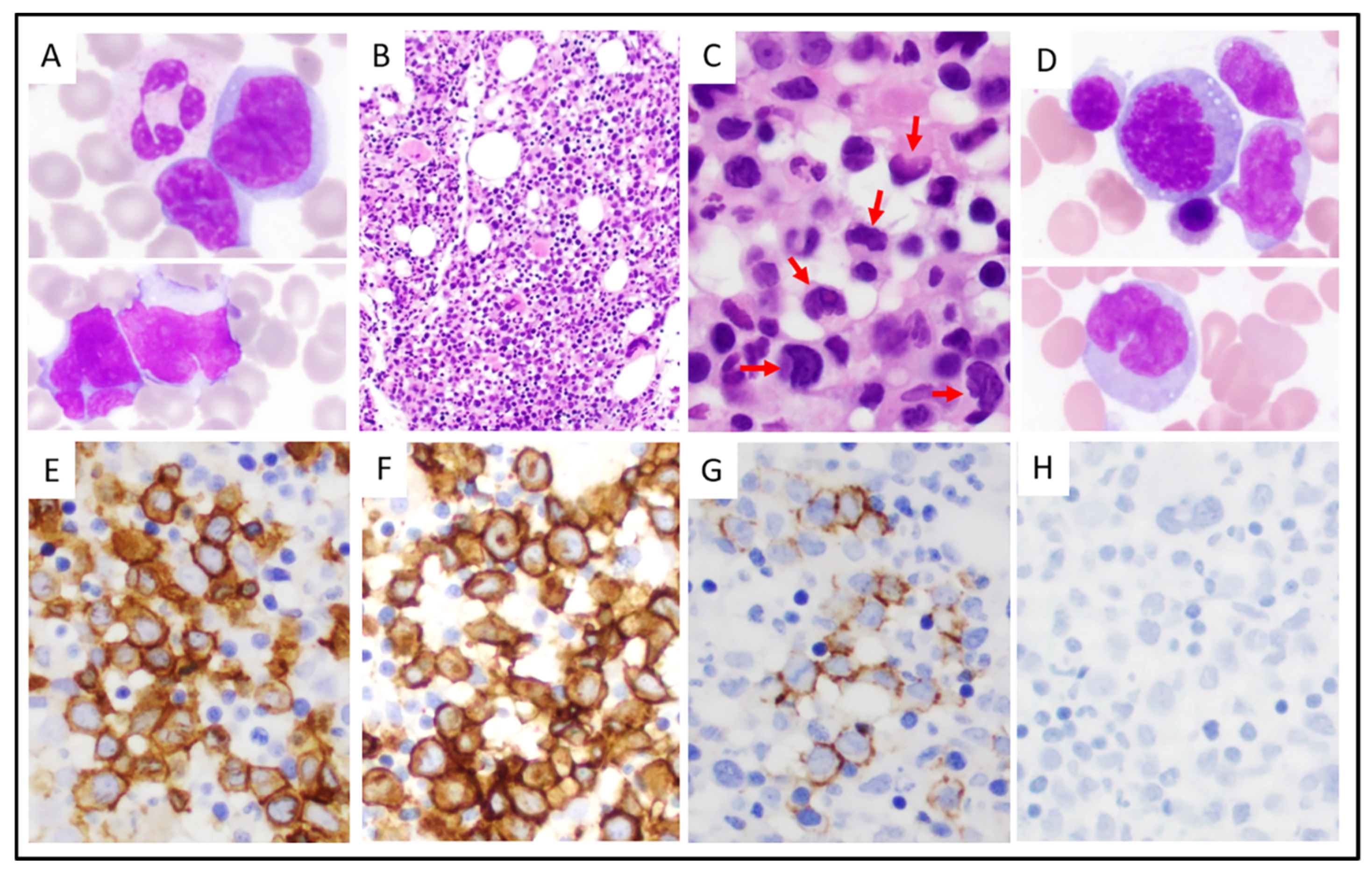 Cancers 13 06316 g001