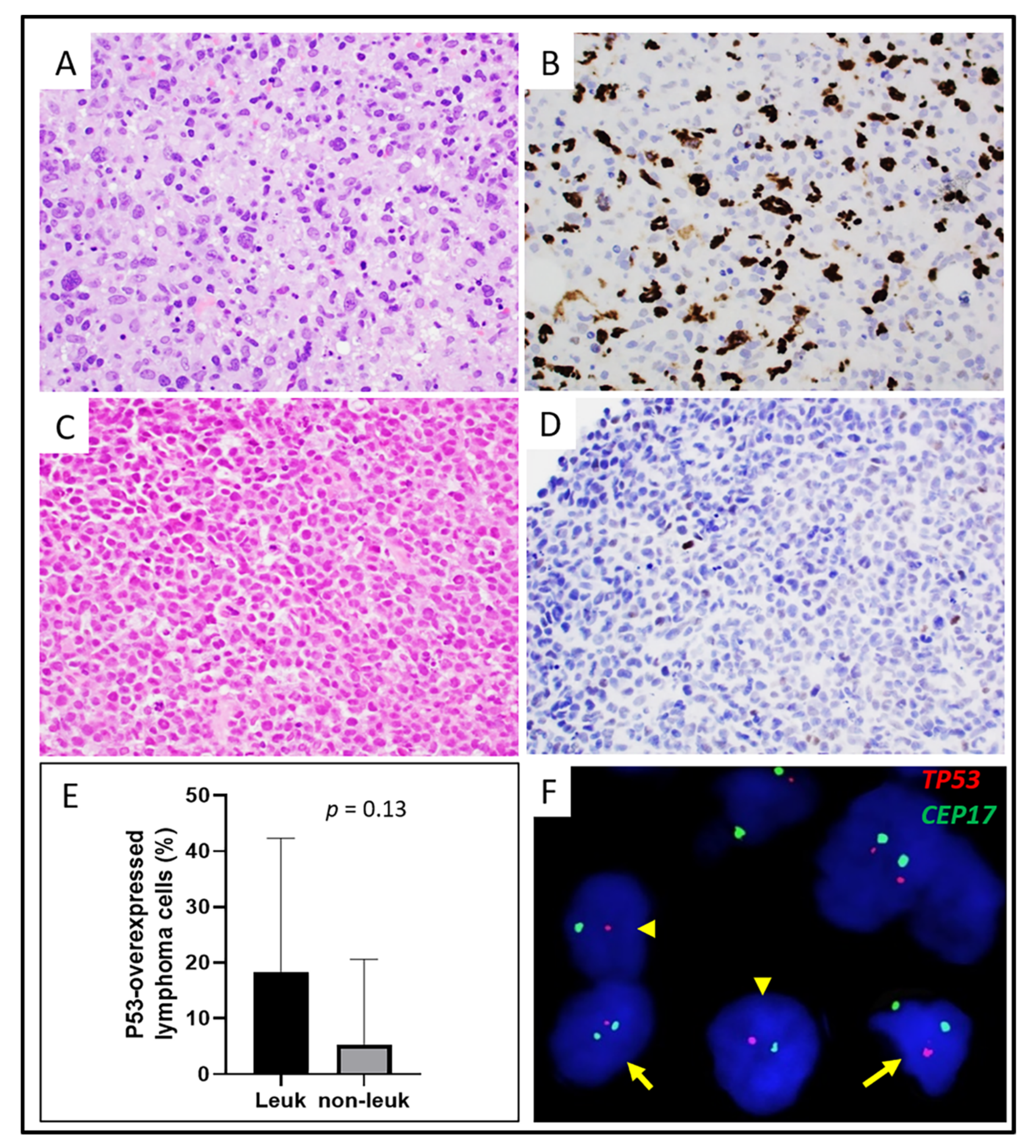 Cancers 13 06316 g003