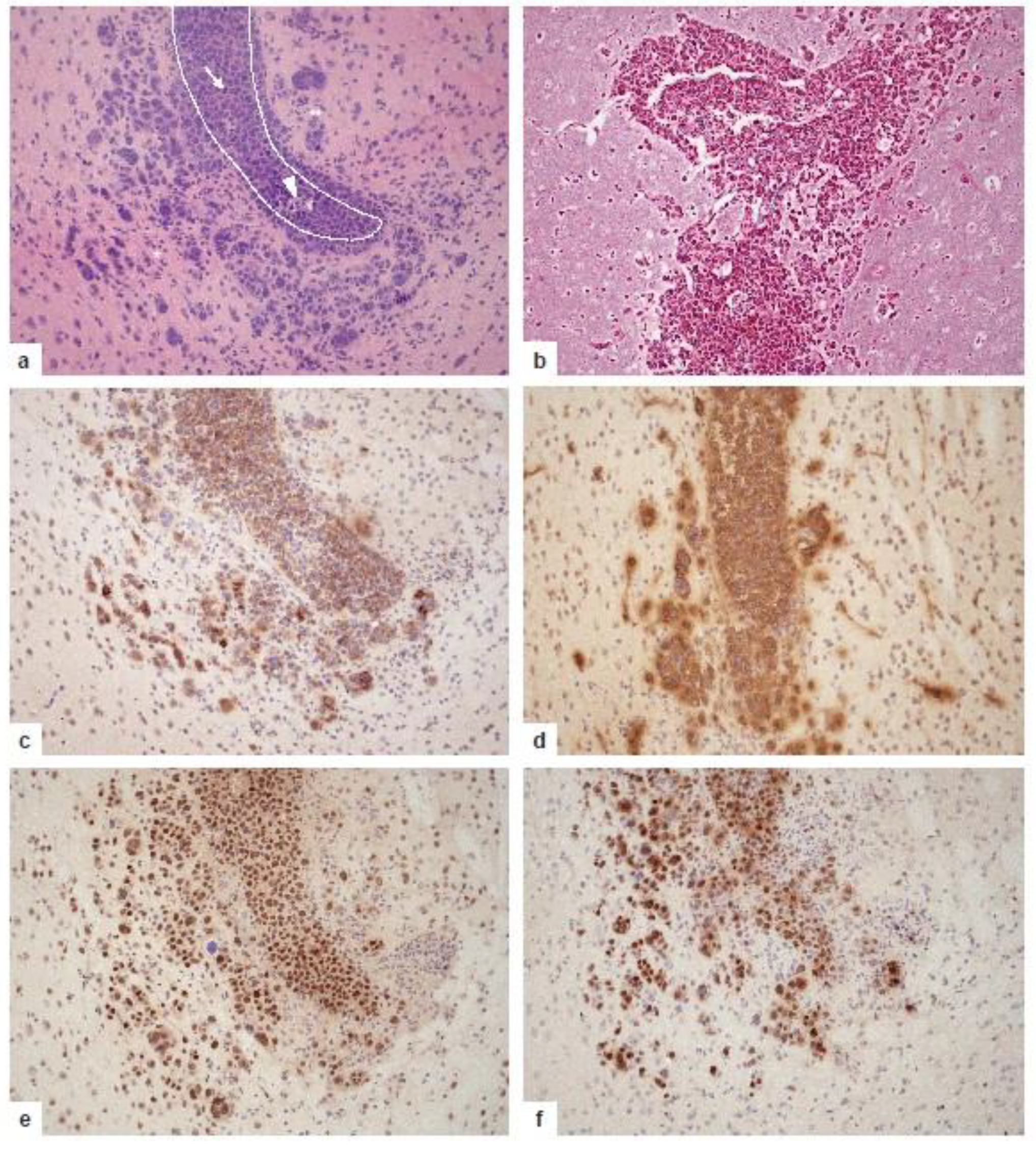 Cancers 13 06334 g005