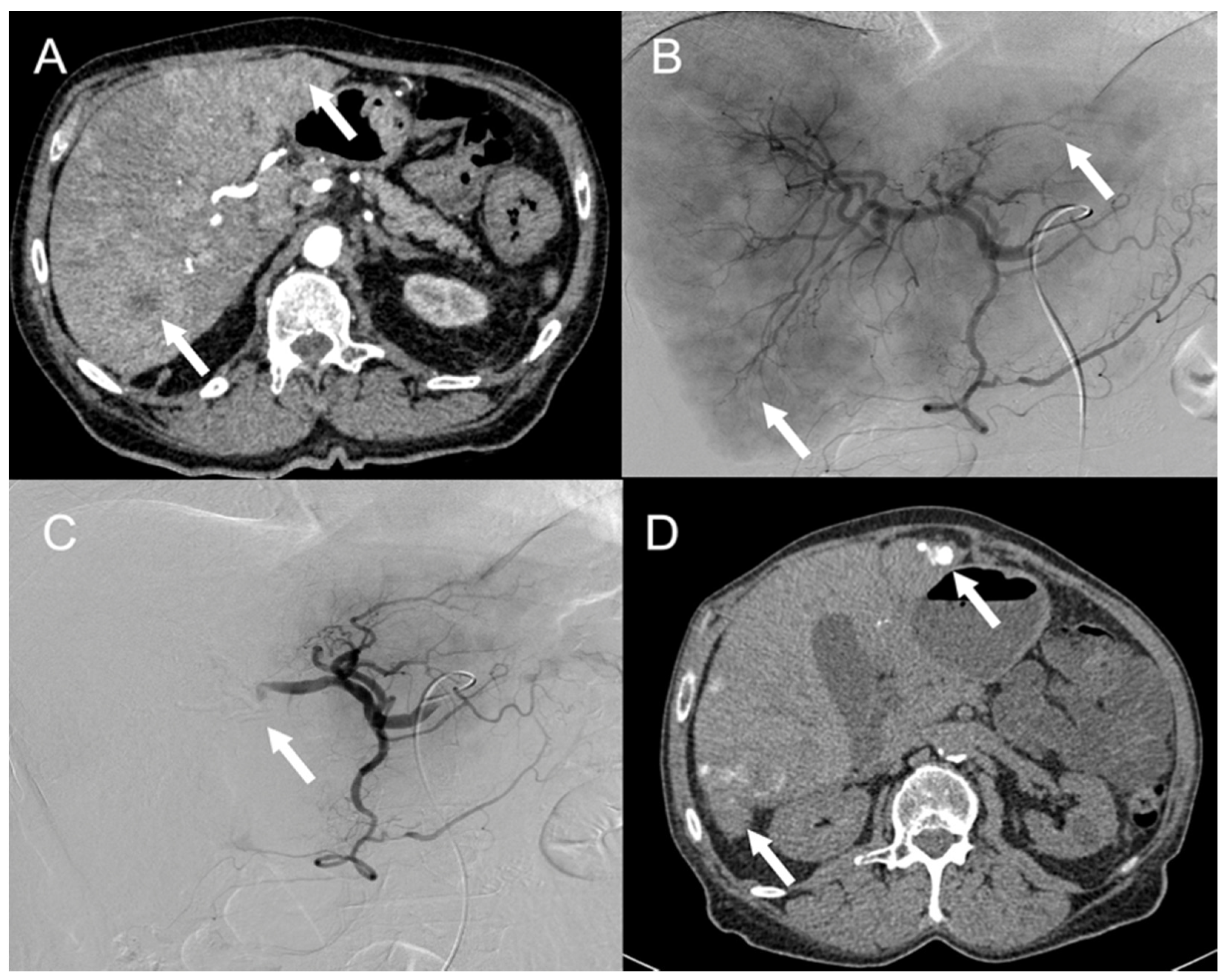 Cancers 13 06368 g004 550