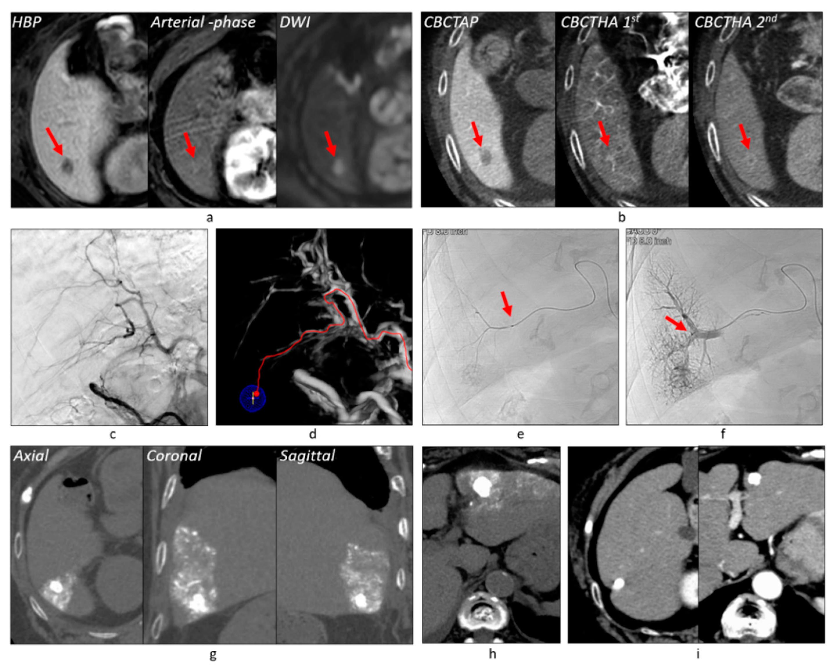 Cancers 13 06370 g003 Cancers 13 06370 g003