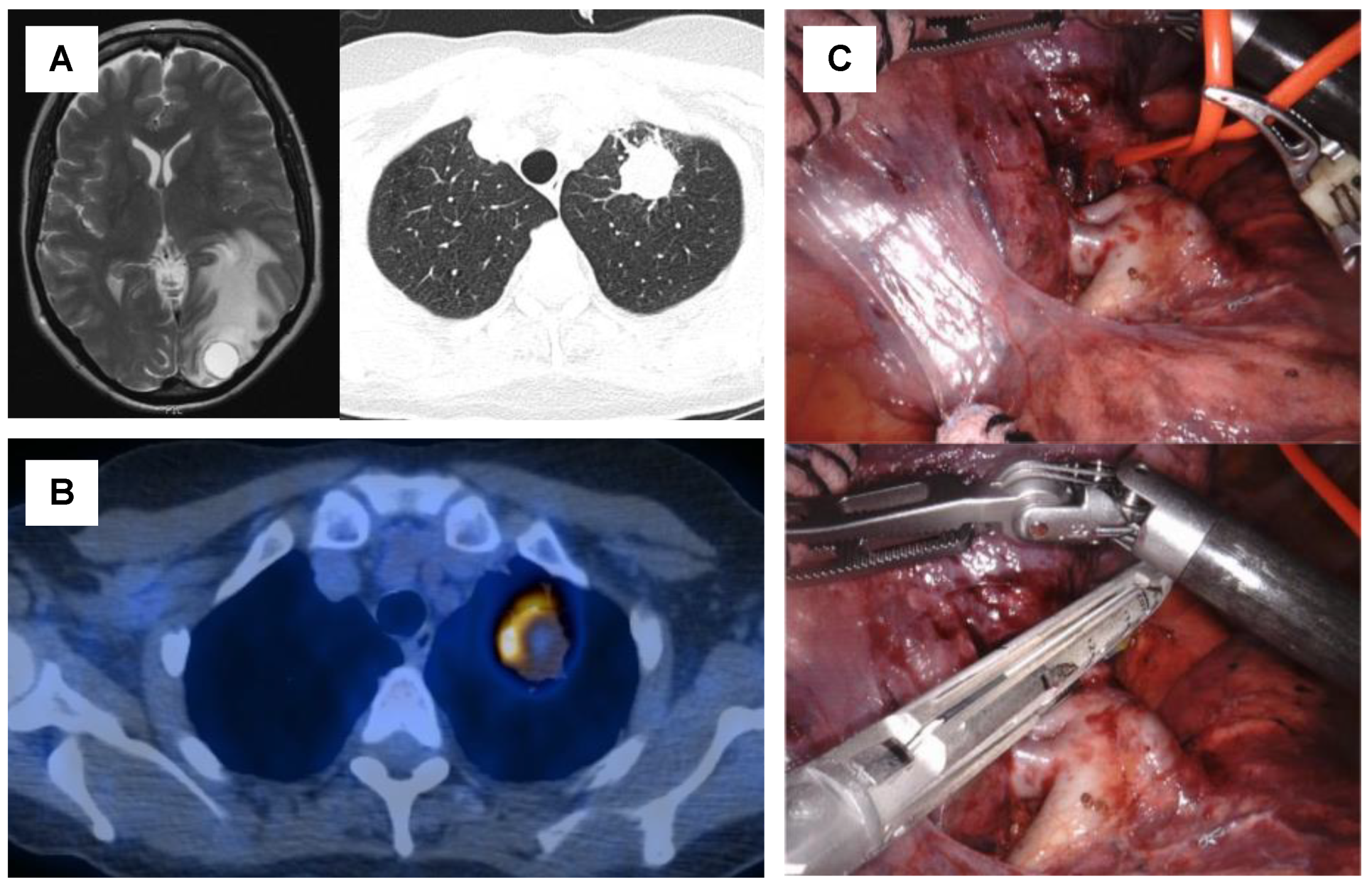 Cancers 13 06374 g002