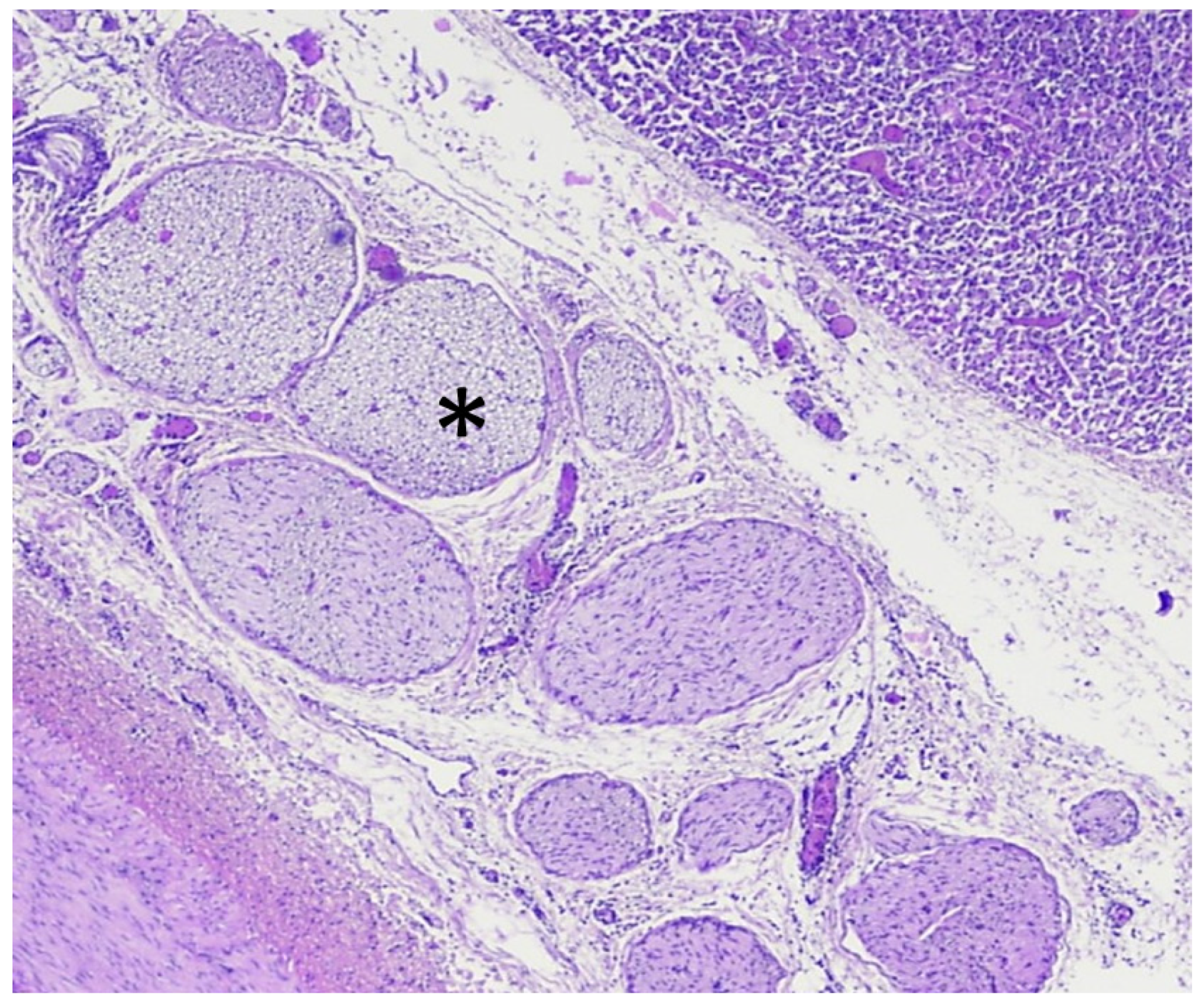 Cancers 13 06381 g007