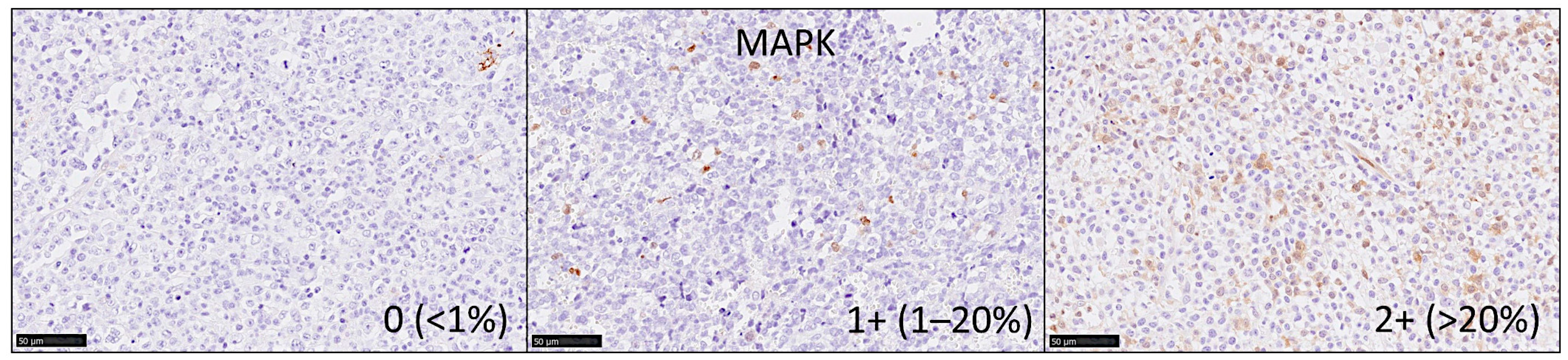 Cancers 13 06384 g006 550