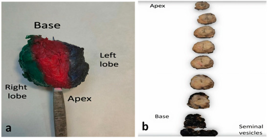 Cancers 14 00013 g001 550